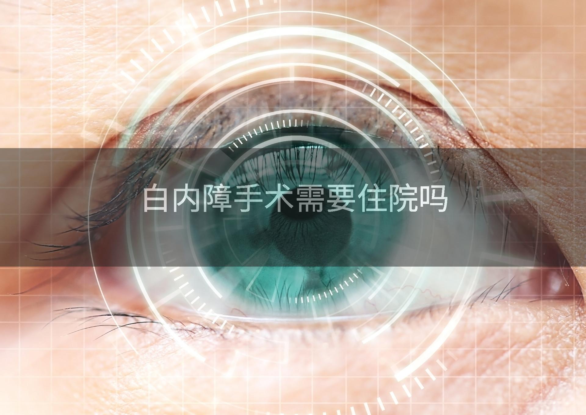 白内障手术需要住院吗