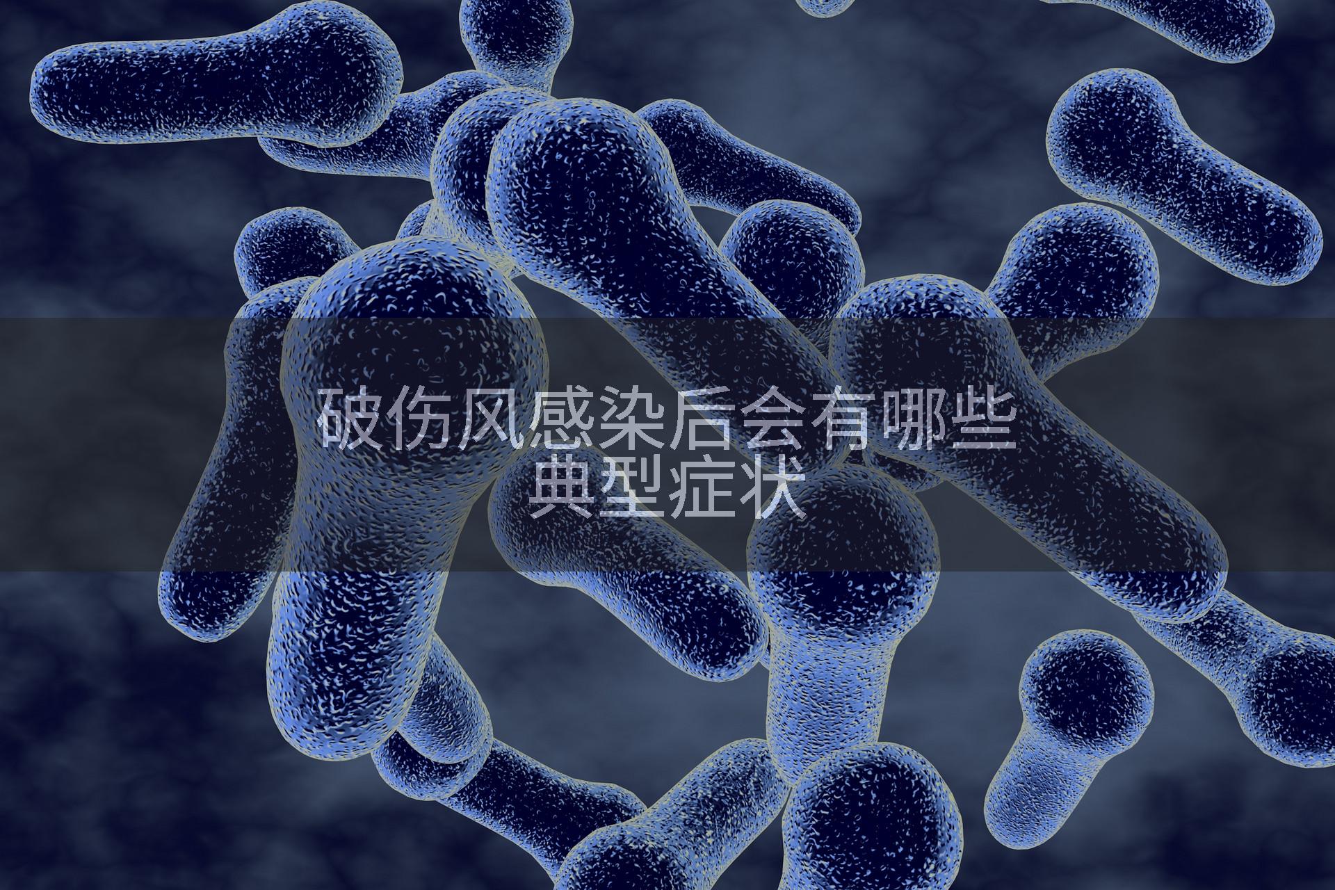 破伤风感染后会有哪些典型症状