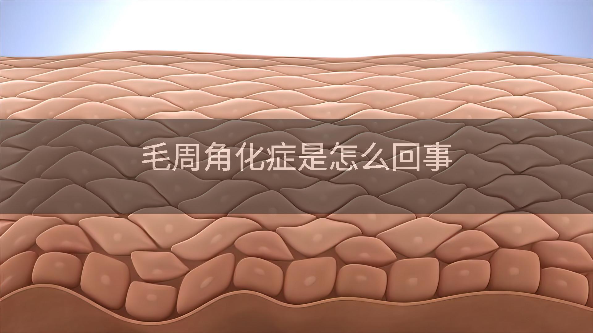 毛周角化症是怎么回事