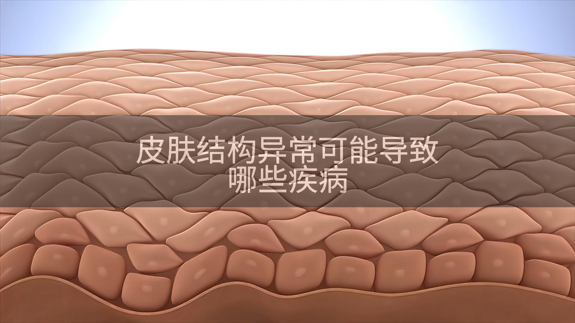 皮肤结构异常可能导致哪些疾病