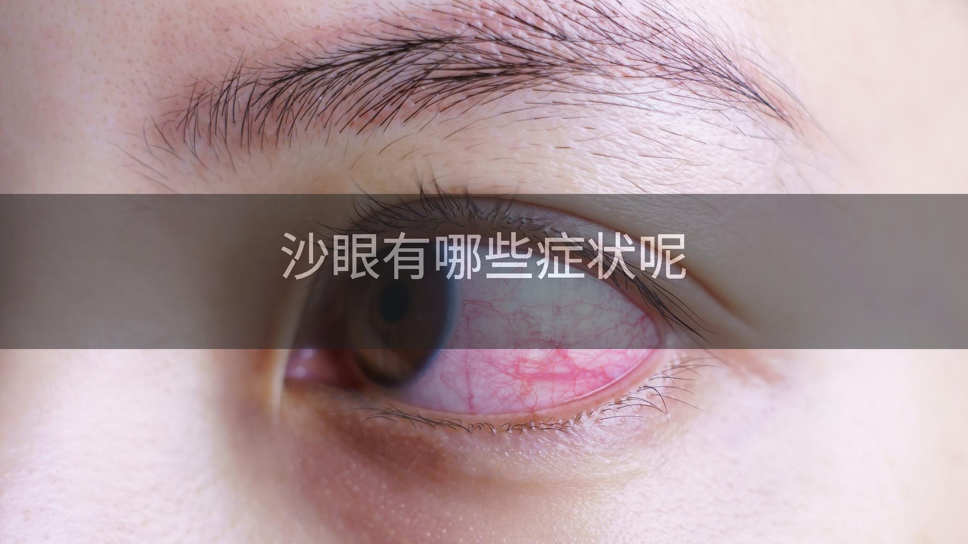 沙眼有哪些症状呢