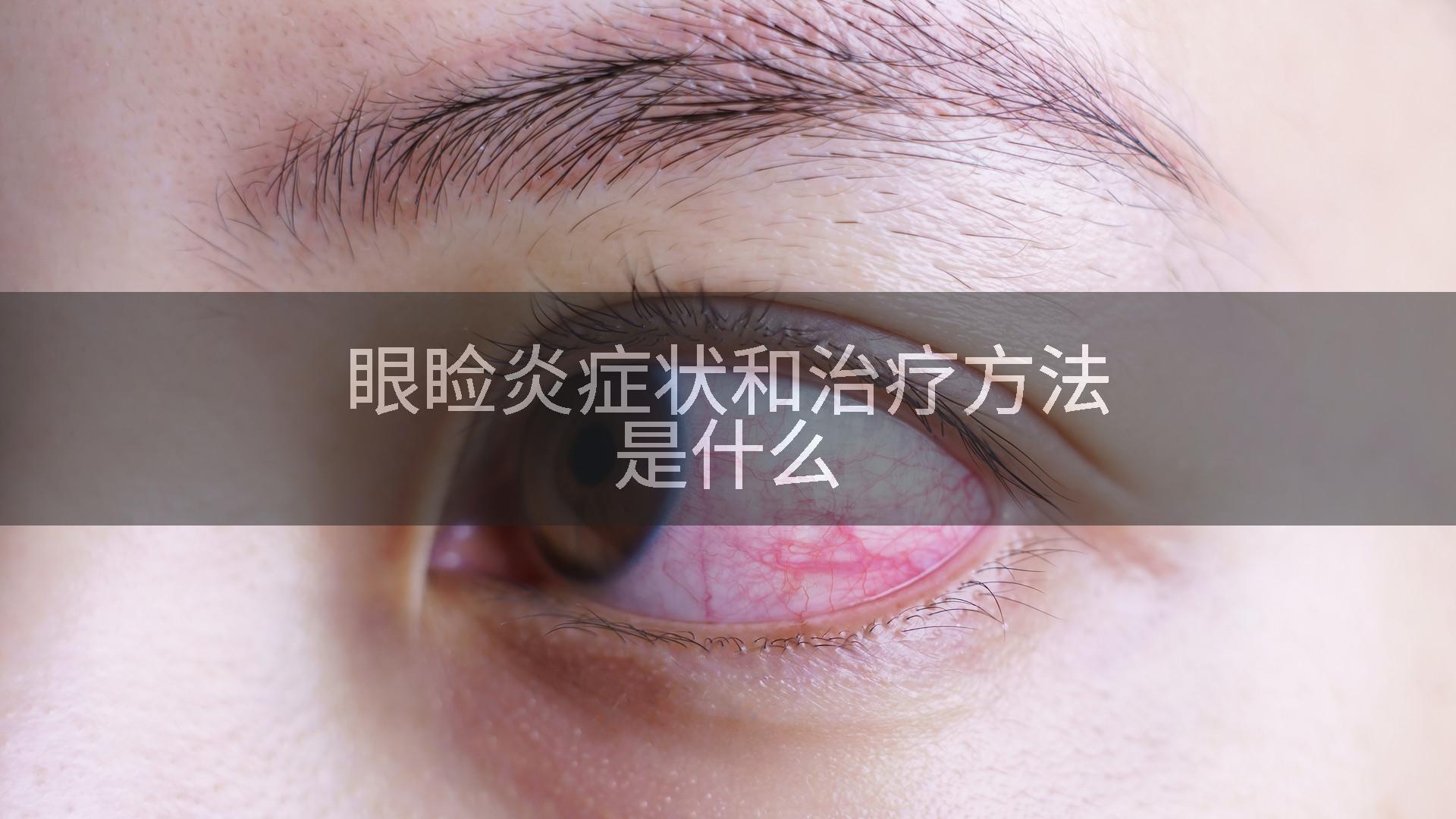 眼睑炎症状和治疗方法是什么