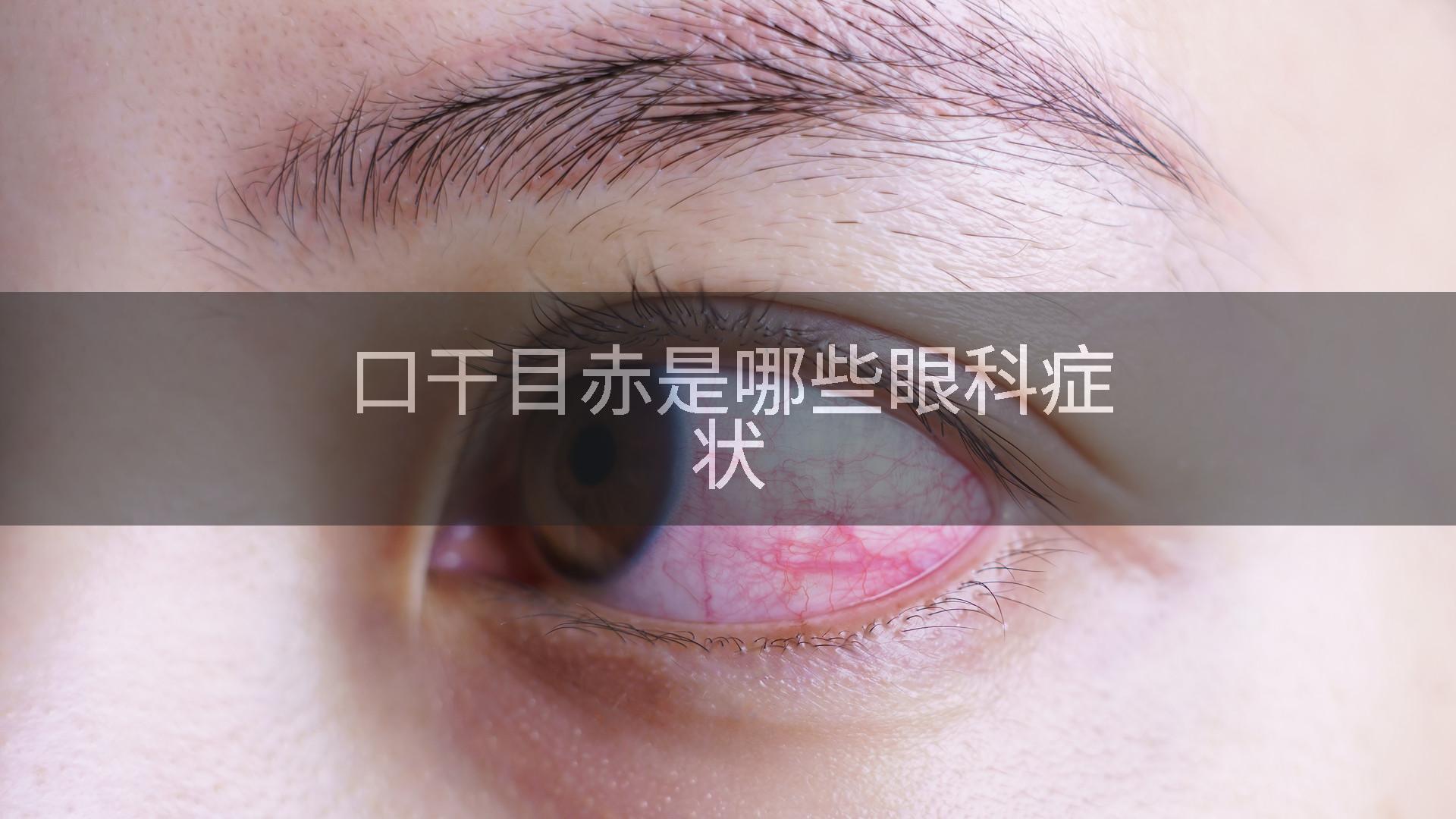 口干目赤是哪些眼科症状