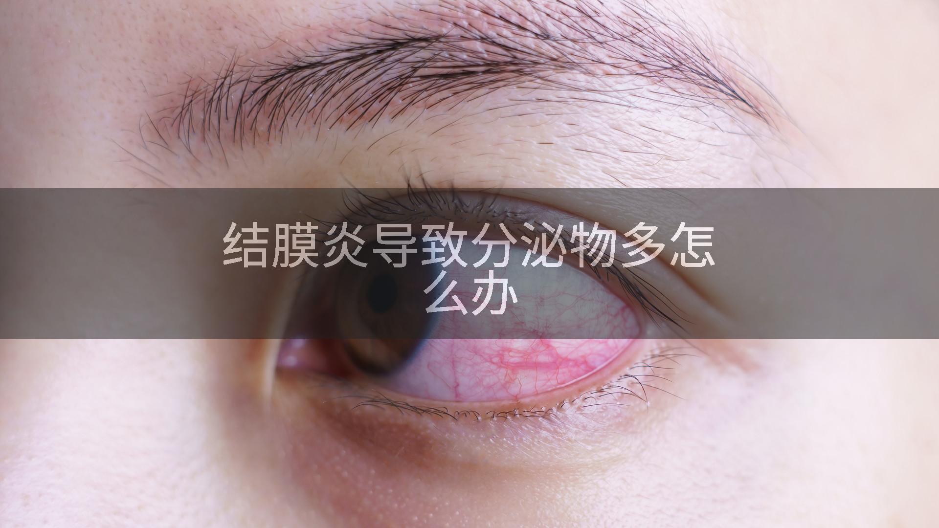 结膜炎导致分泌物多怎么办