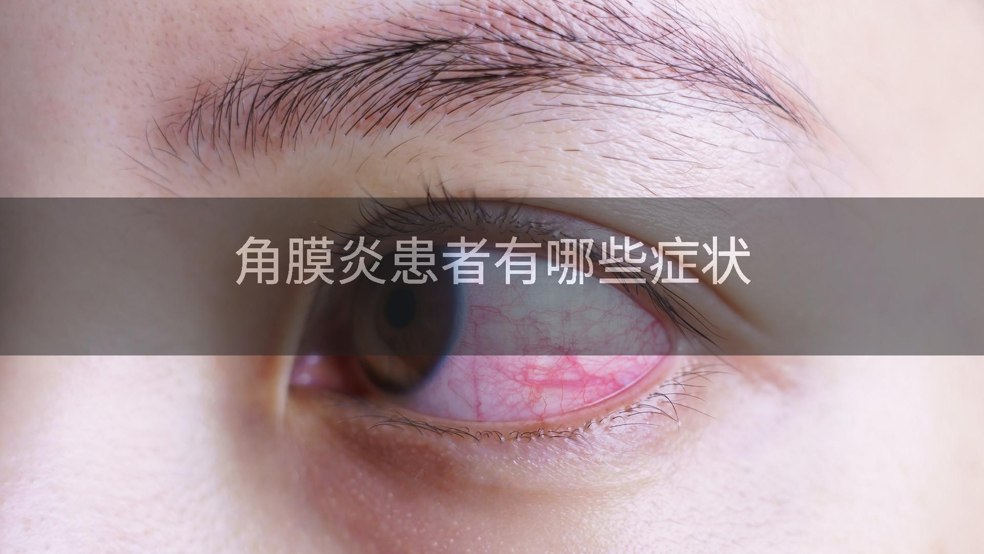 角膜炎患者有哪些症状