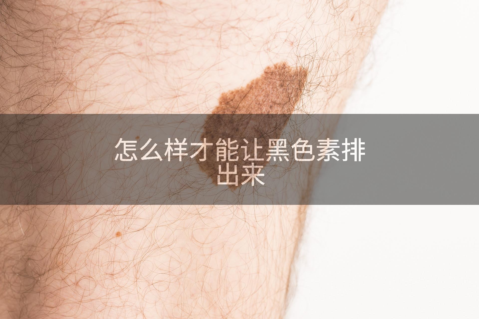 怎么样才能让黑色素排出来