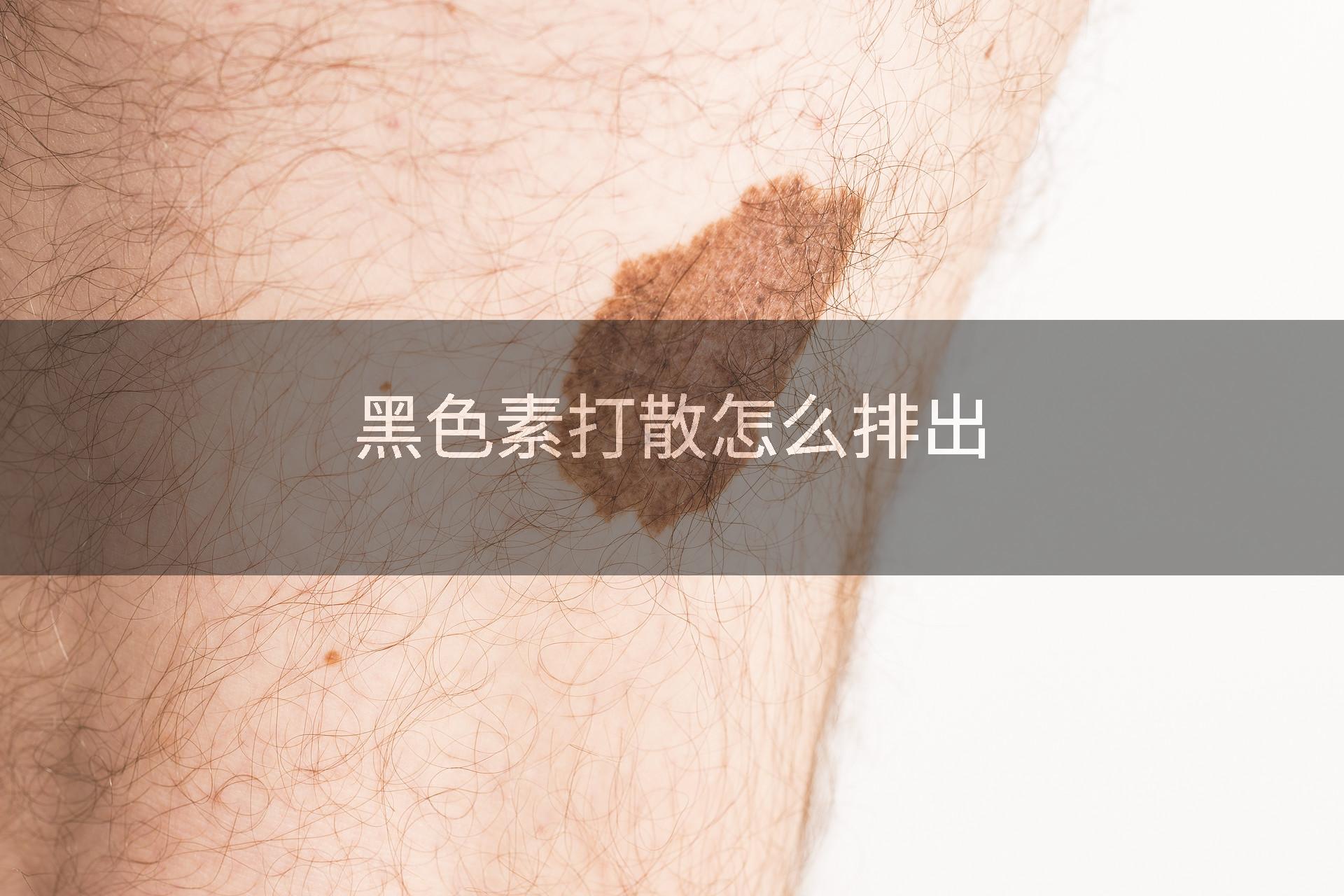黑色素打散怎么排出