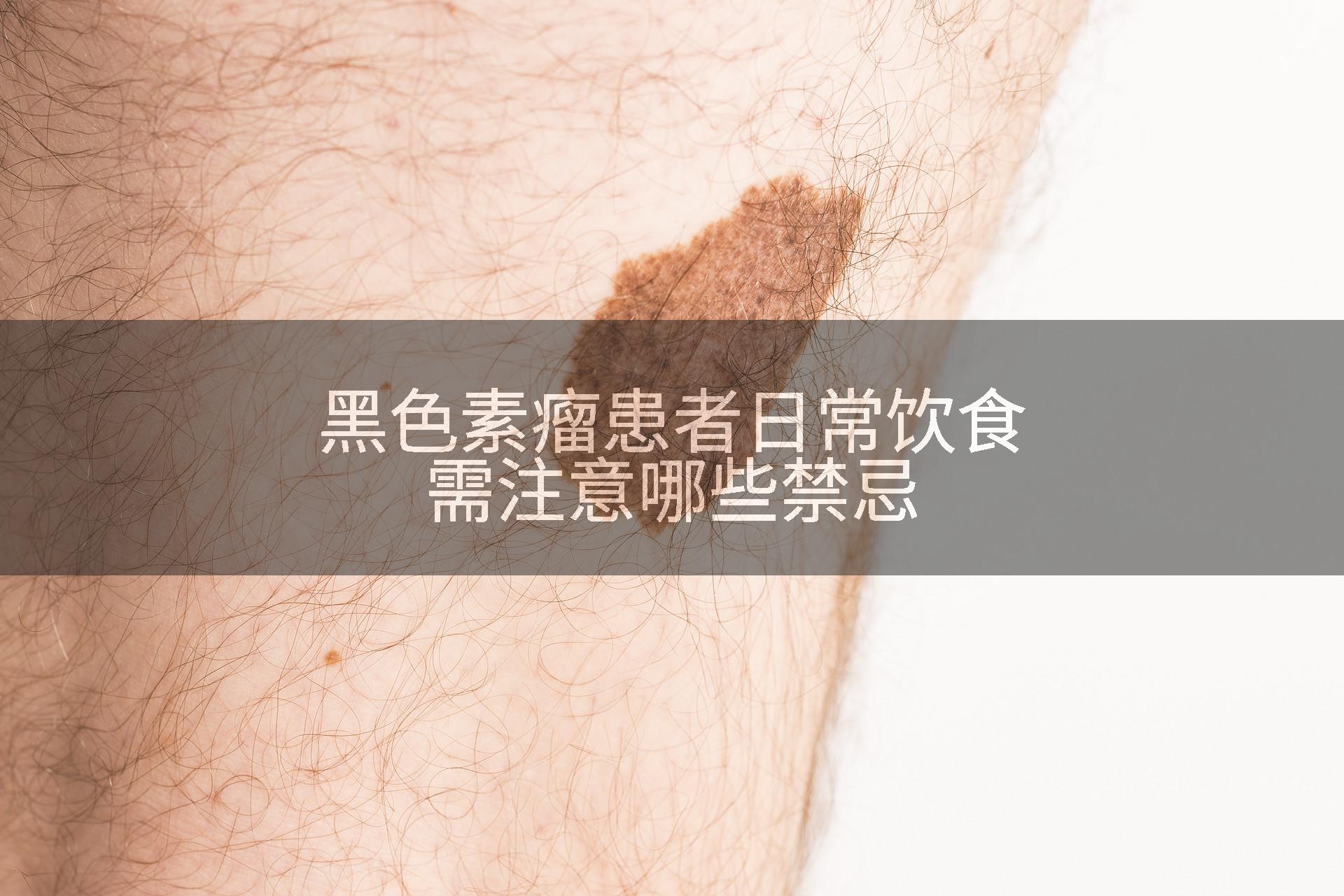 黑色素瘤患者日常饮食需注意哪些禁忌