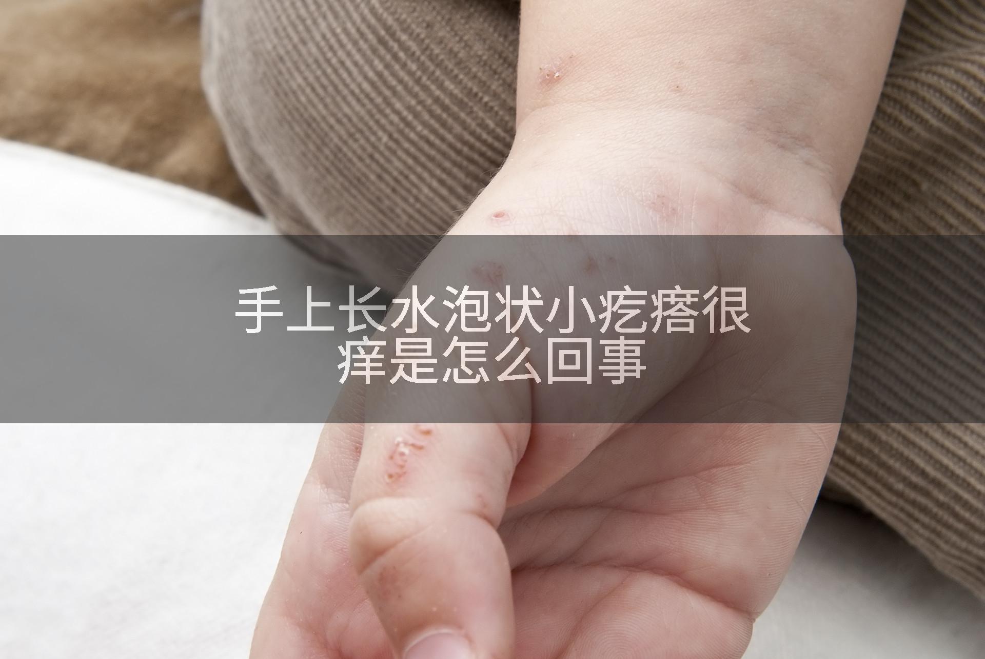 手上長水泡狀小疙瘩很癢是怎么回事