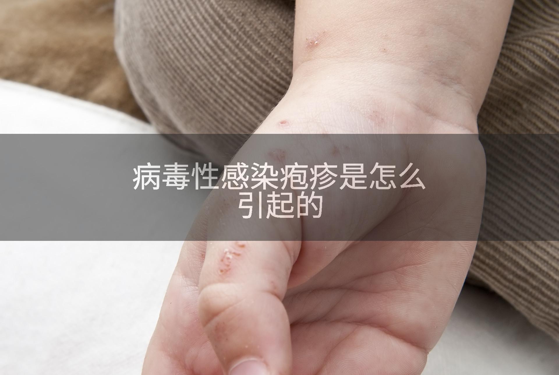 病毒性感染疱疹是怎么引起的
