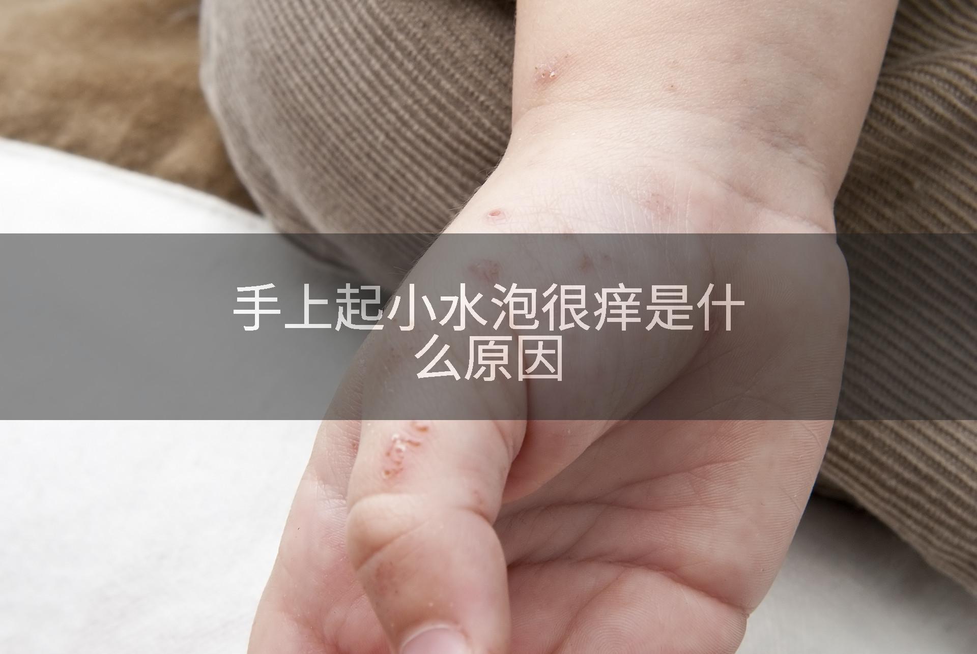 手上起小水泡很痒是什么原因