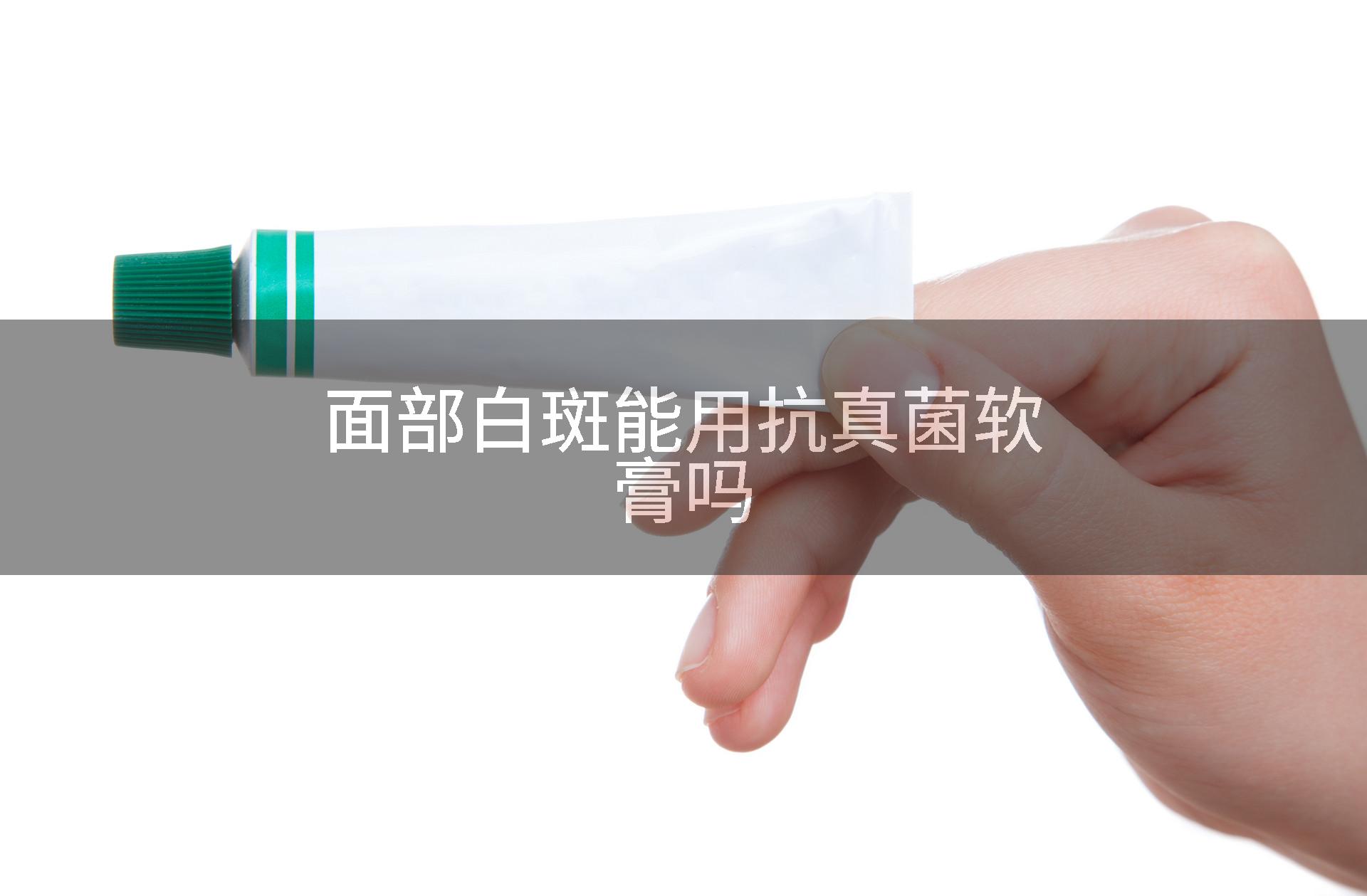 面部白斑能用抗真菌软膏吗