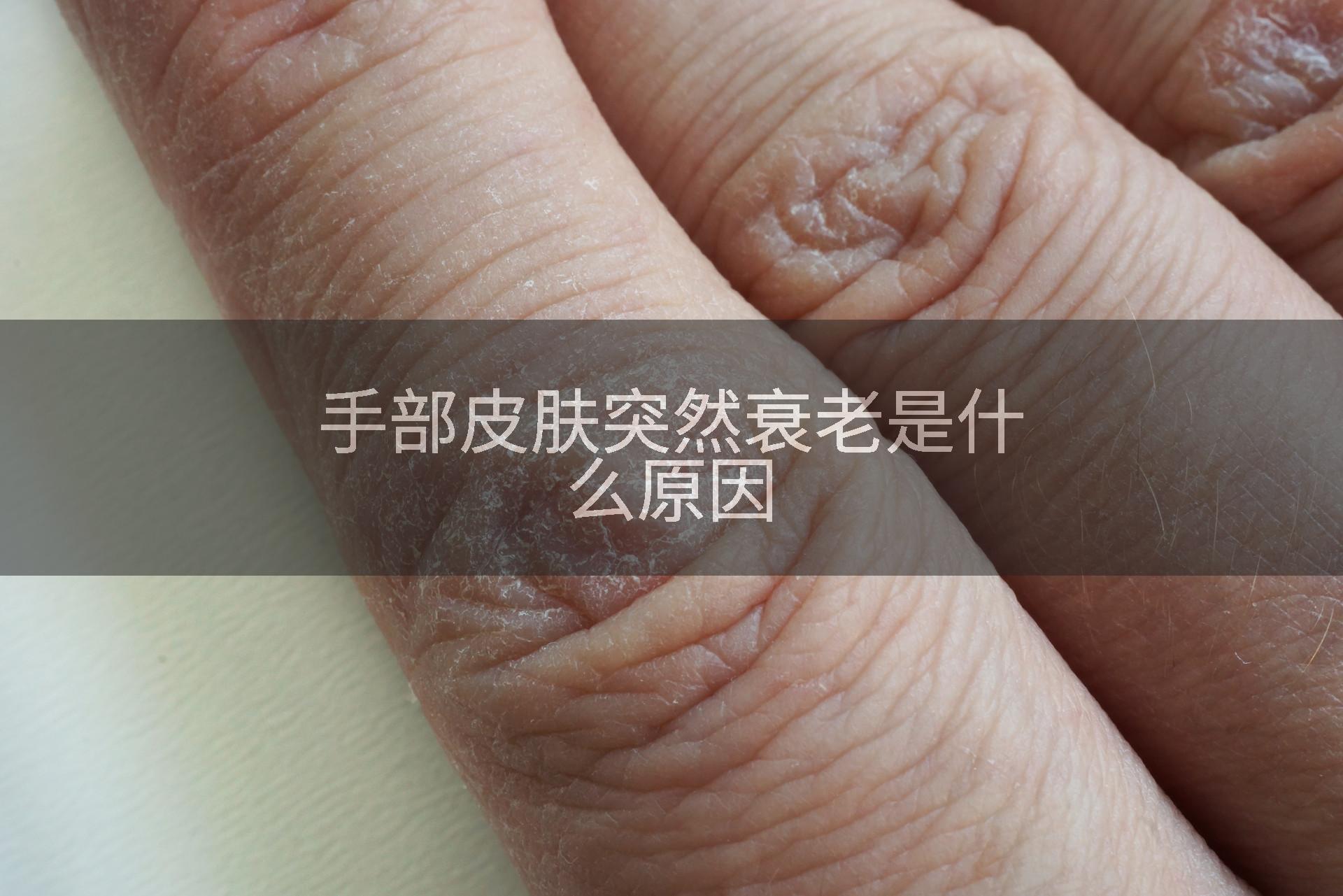 手部皮肤突然衰老是什么原因