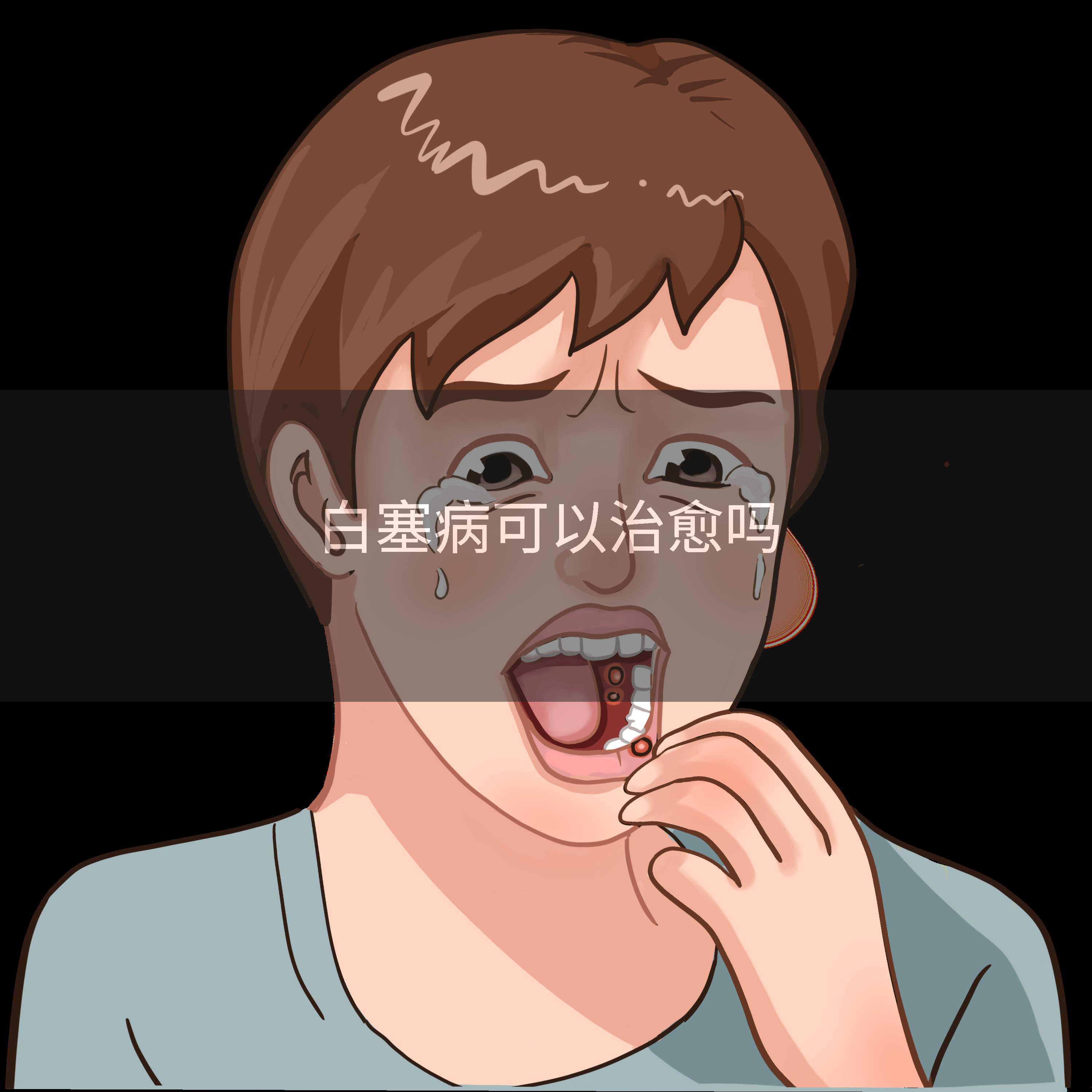 白塞病可以治愈吗