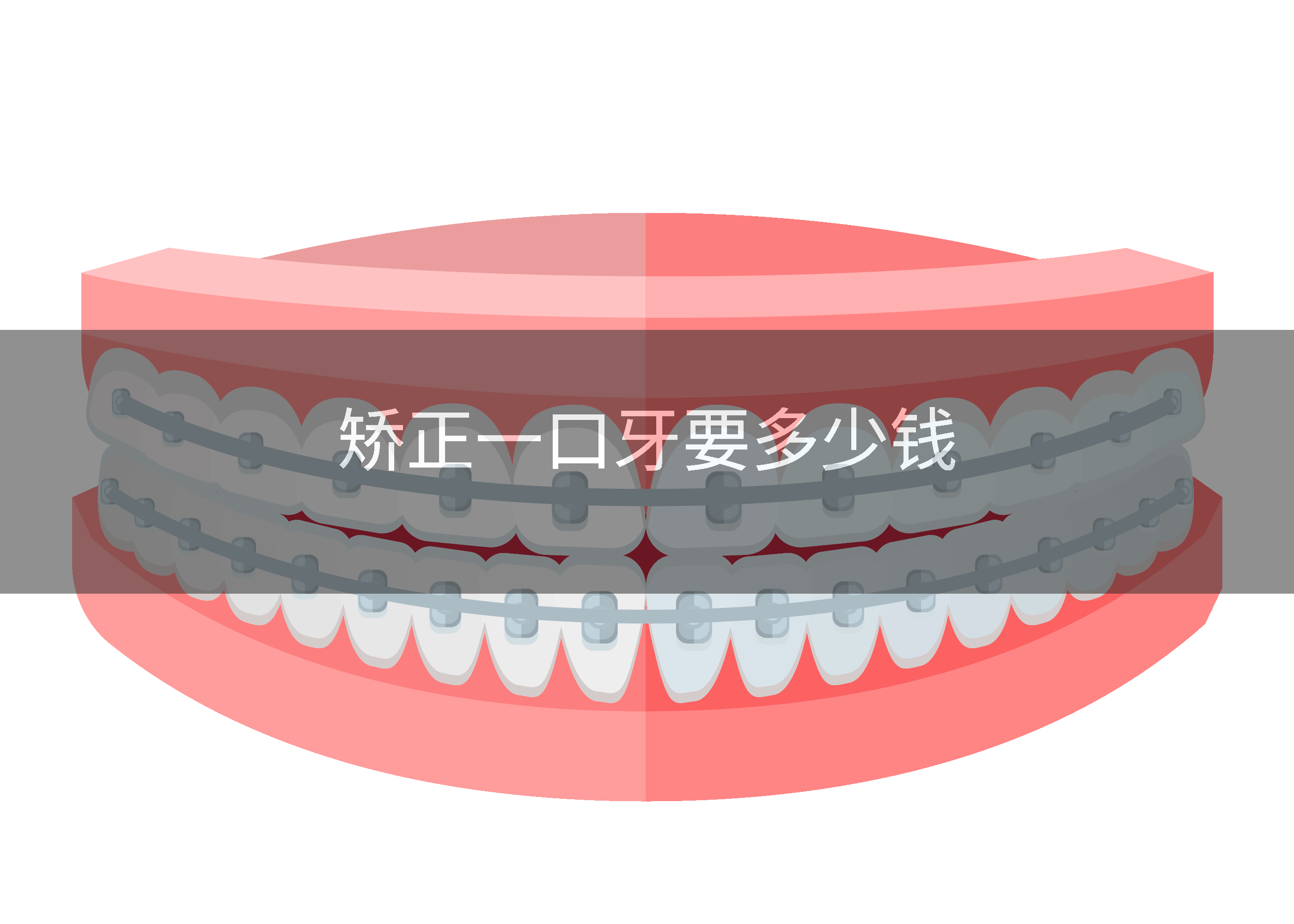 矫正一口牙要多少钱