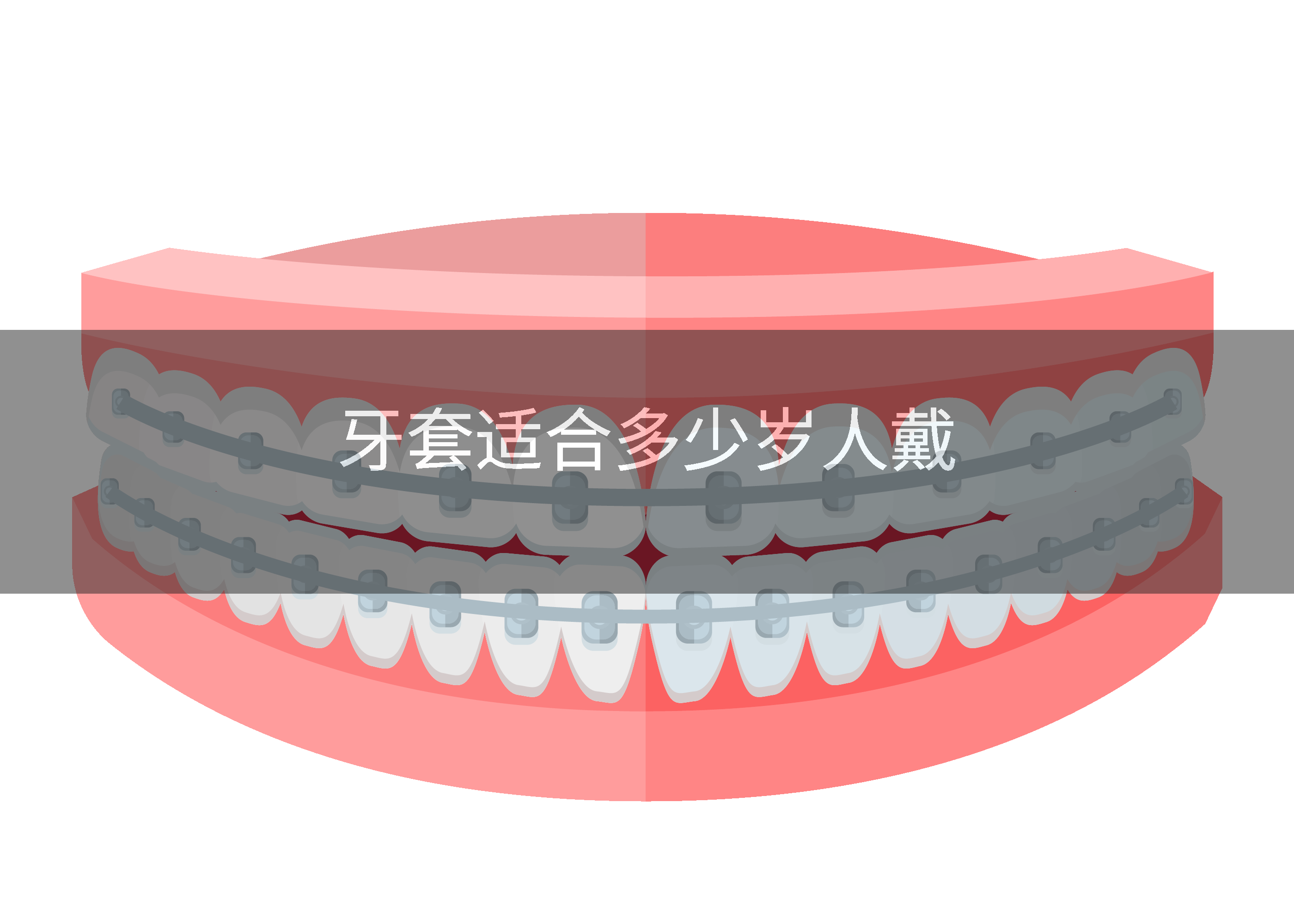 牙套适合多少岁人戴