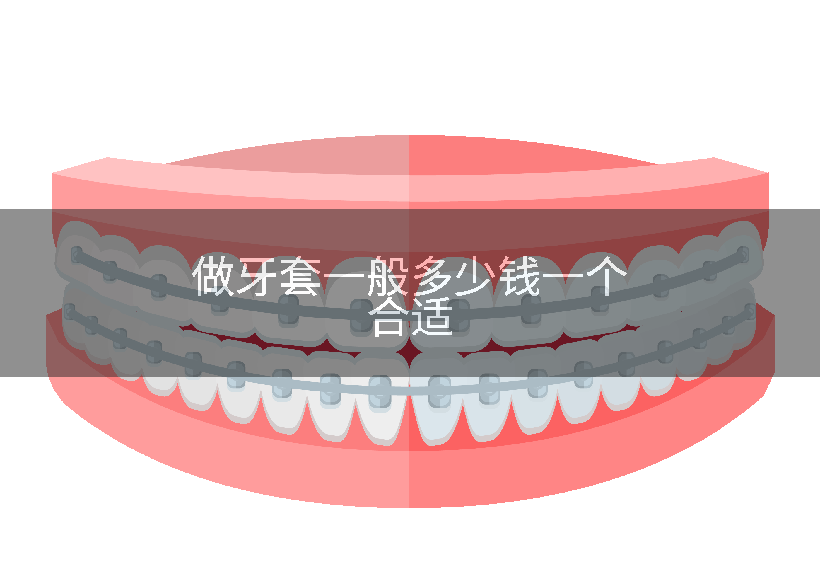 做牙套一般多少钱一个合适