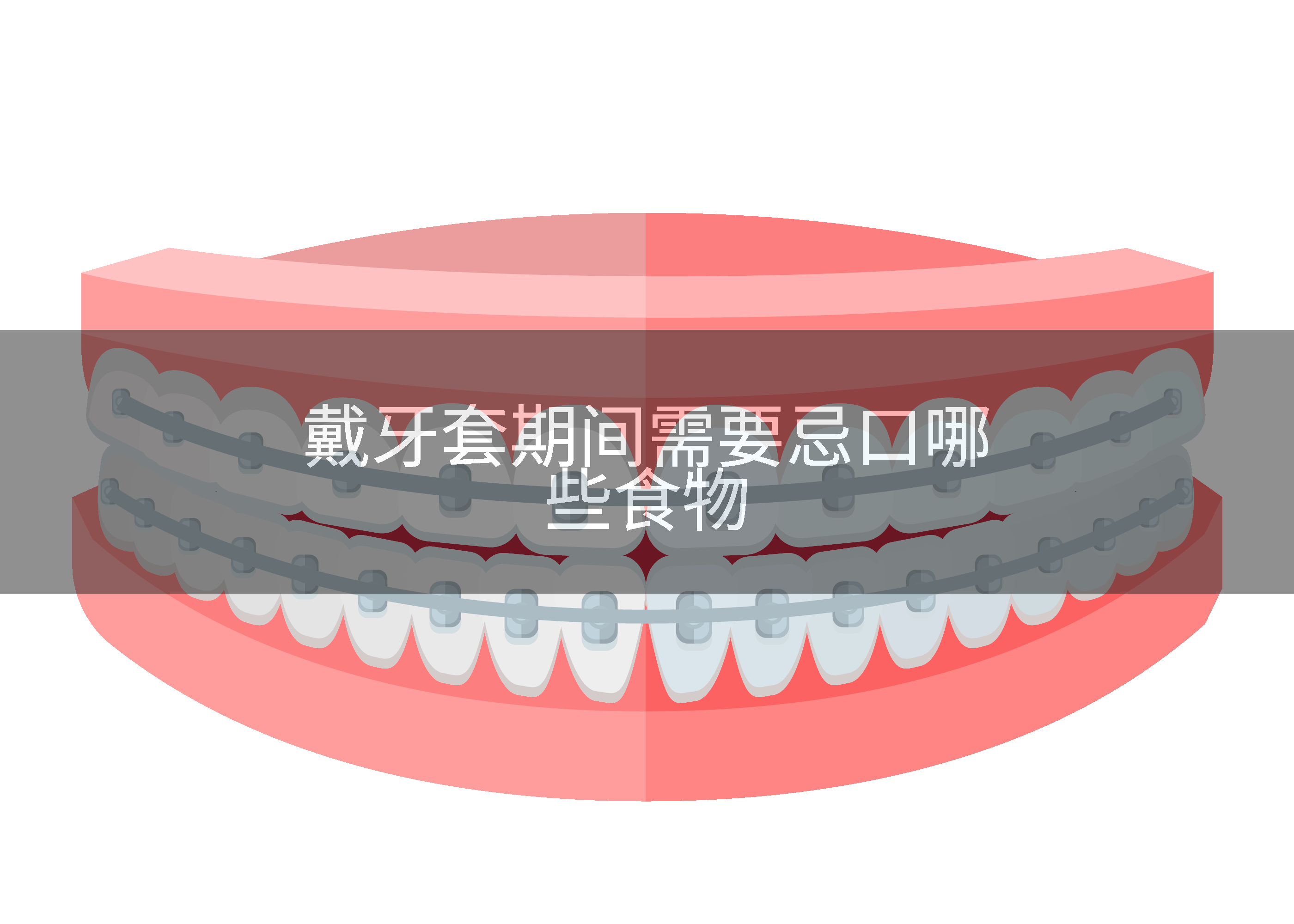 戴牙套期间需要忌口哪些食物