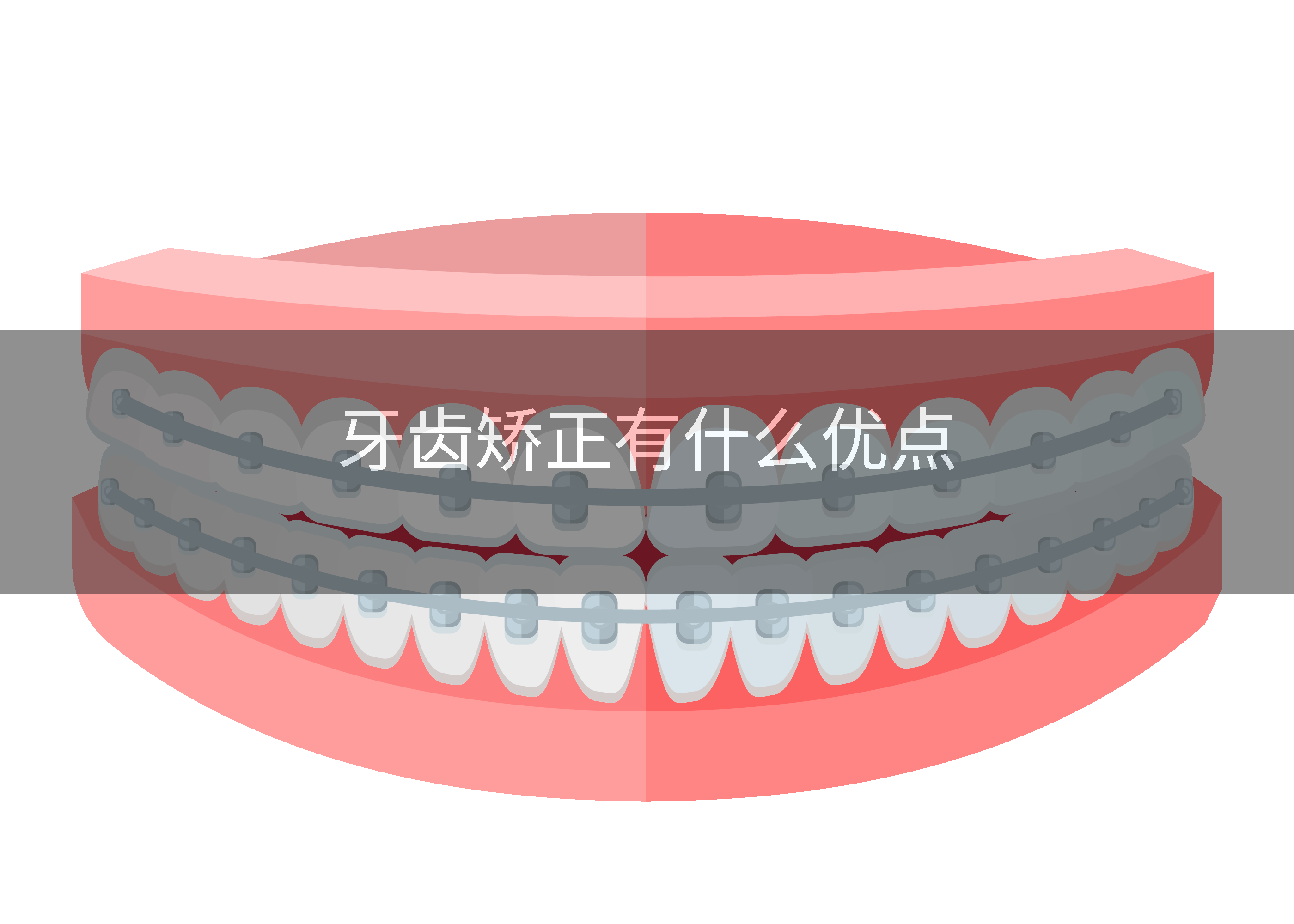 牙齿矫正有什么优点