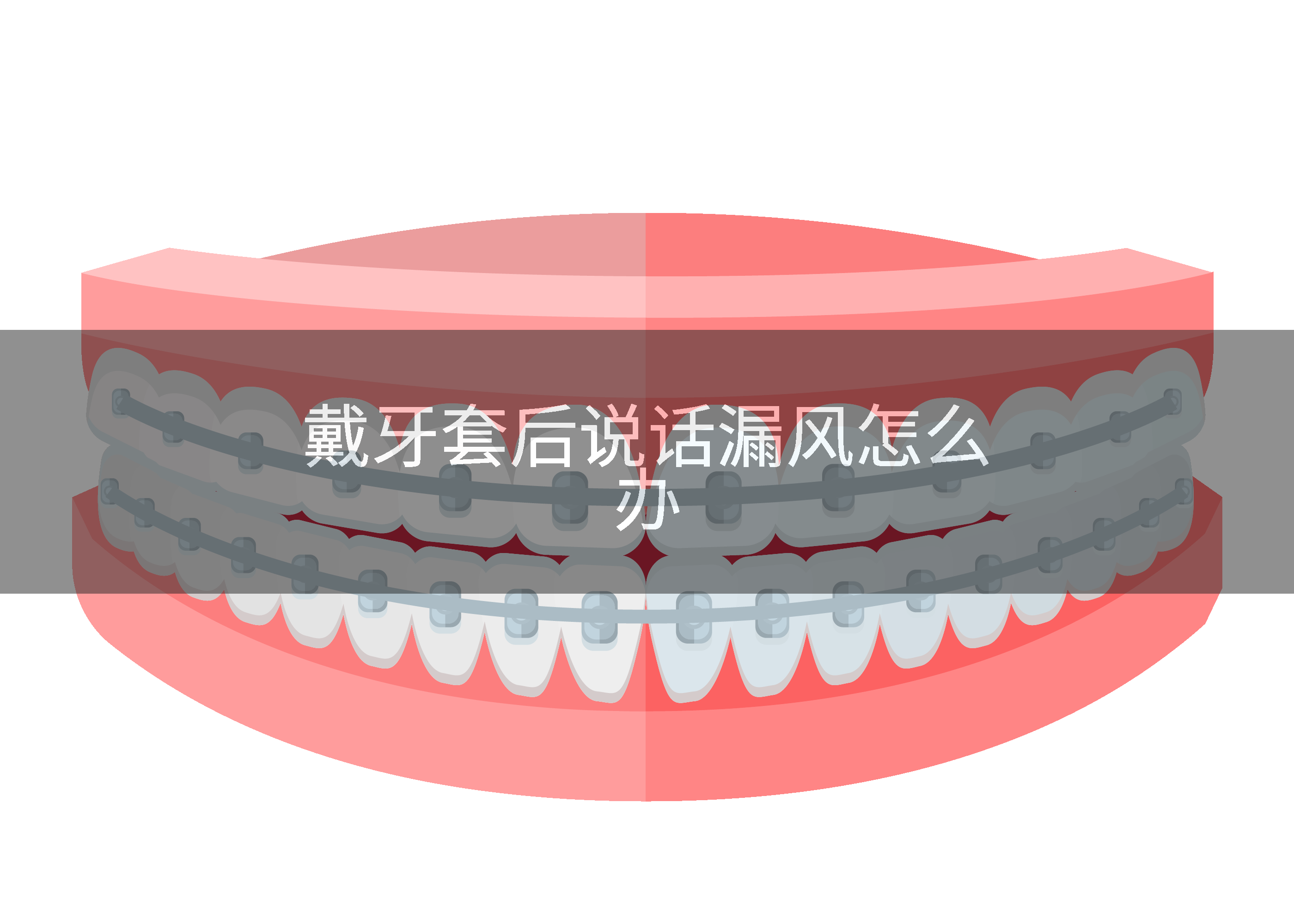 戴牙套后说话漏风怎么办
