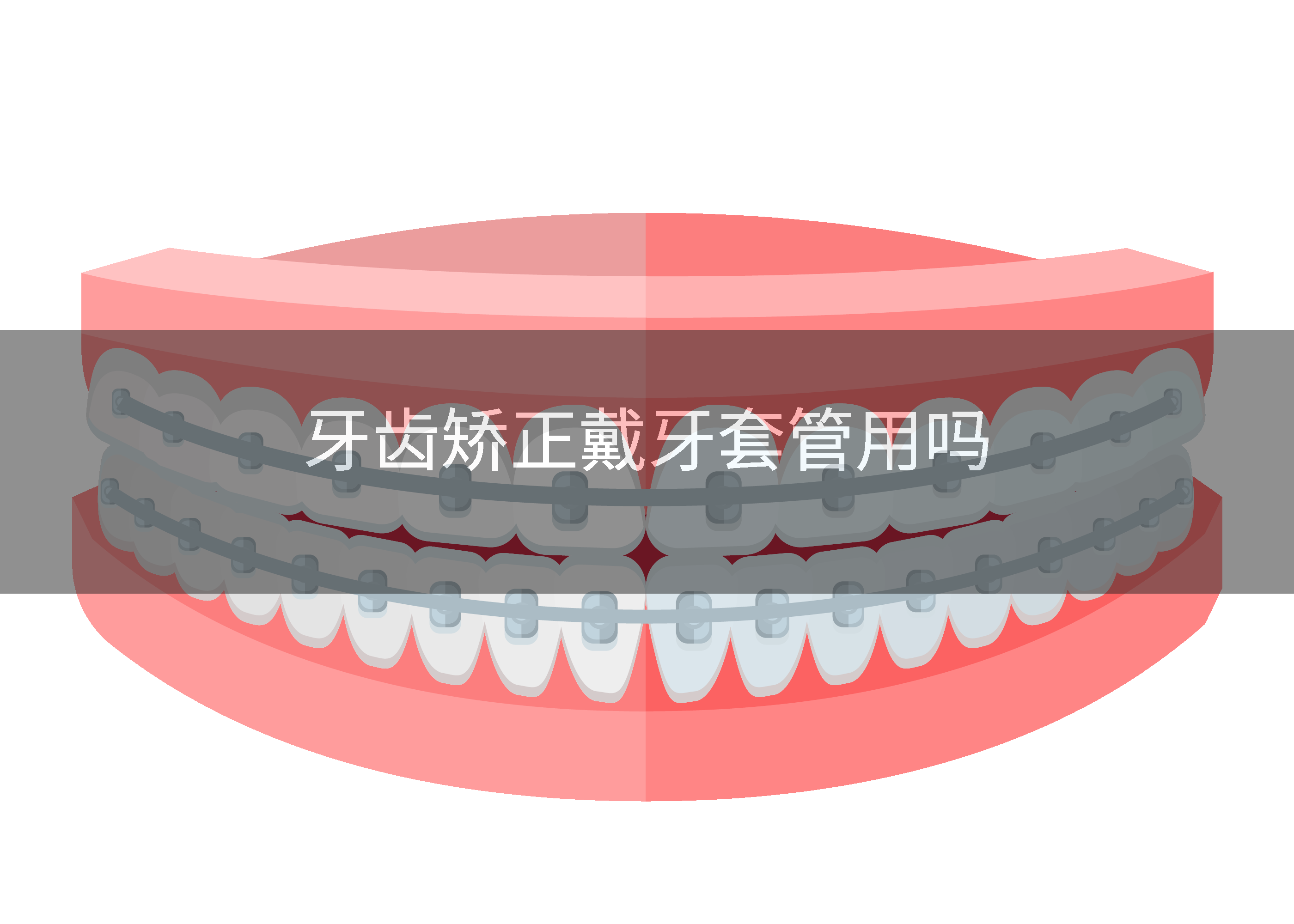 牙齿矫正戴牙套管用吗