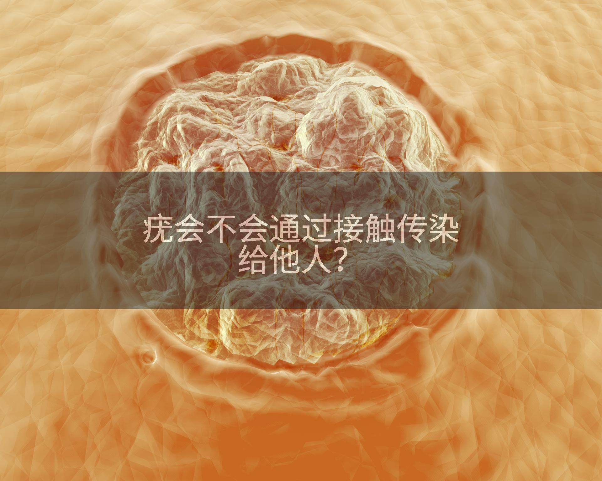 疣会不会通过接触传染给他人？