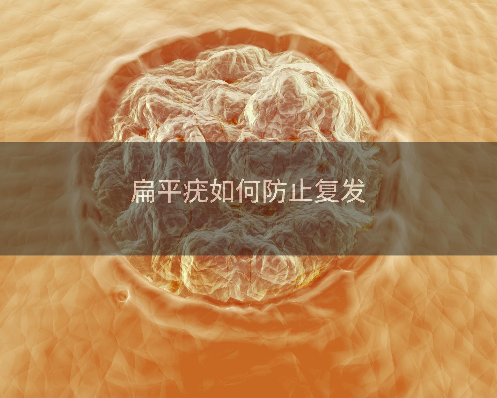 扁平疣如何防止复发