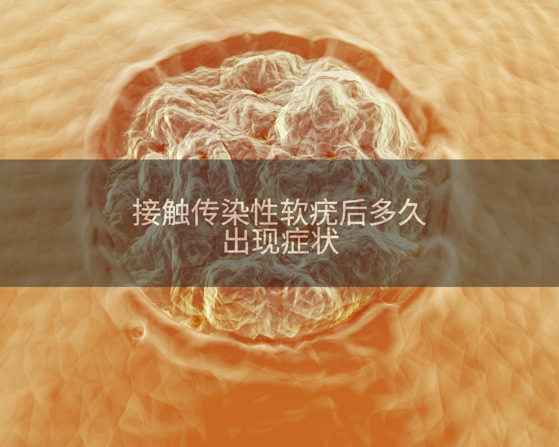接触传染性软疣后多久出现症状