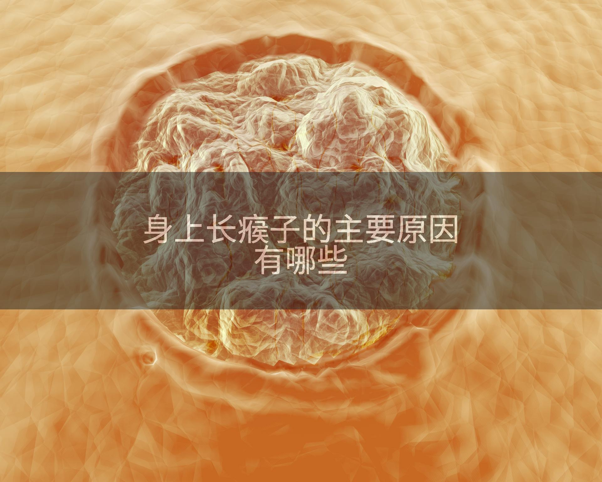 身上长瘊子的主要原因有哪些
