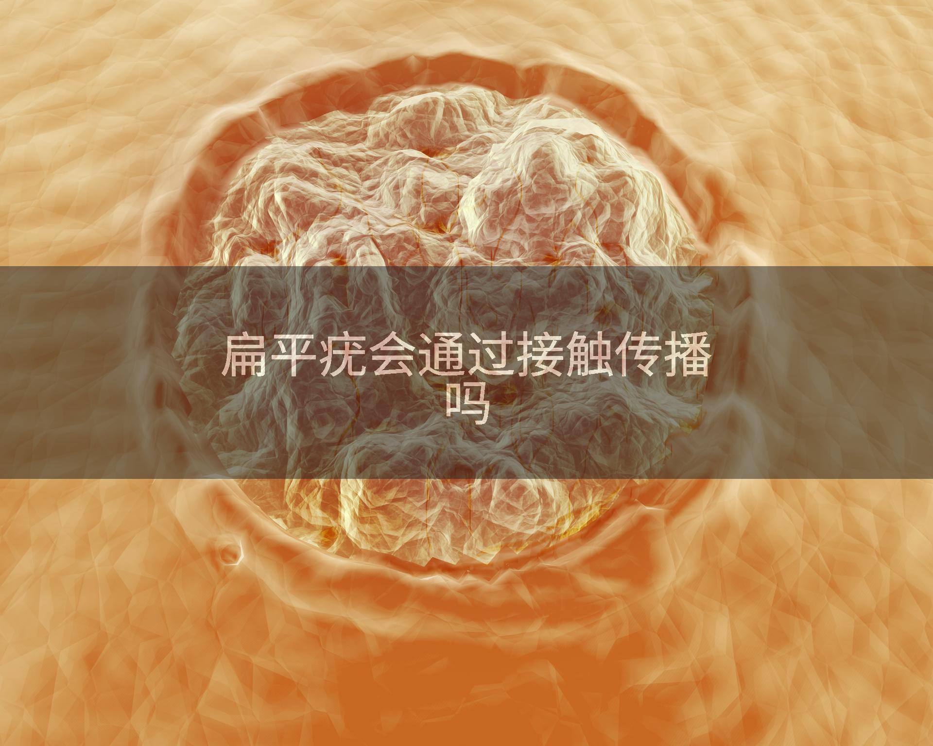 扁平疣会通过接触传播吗