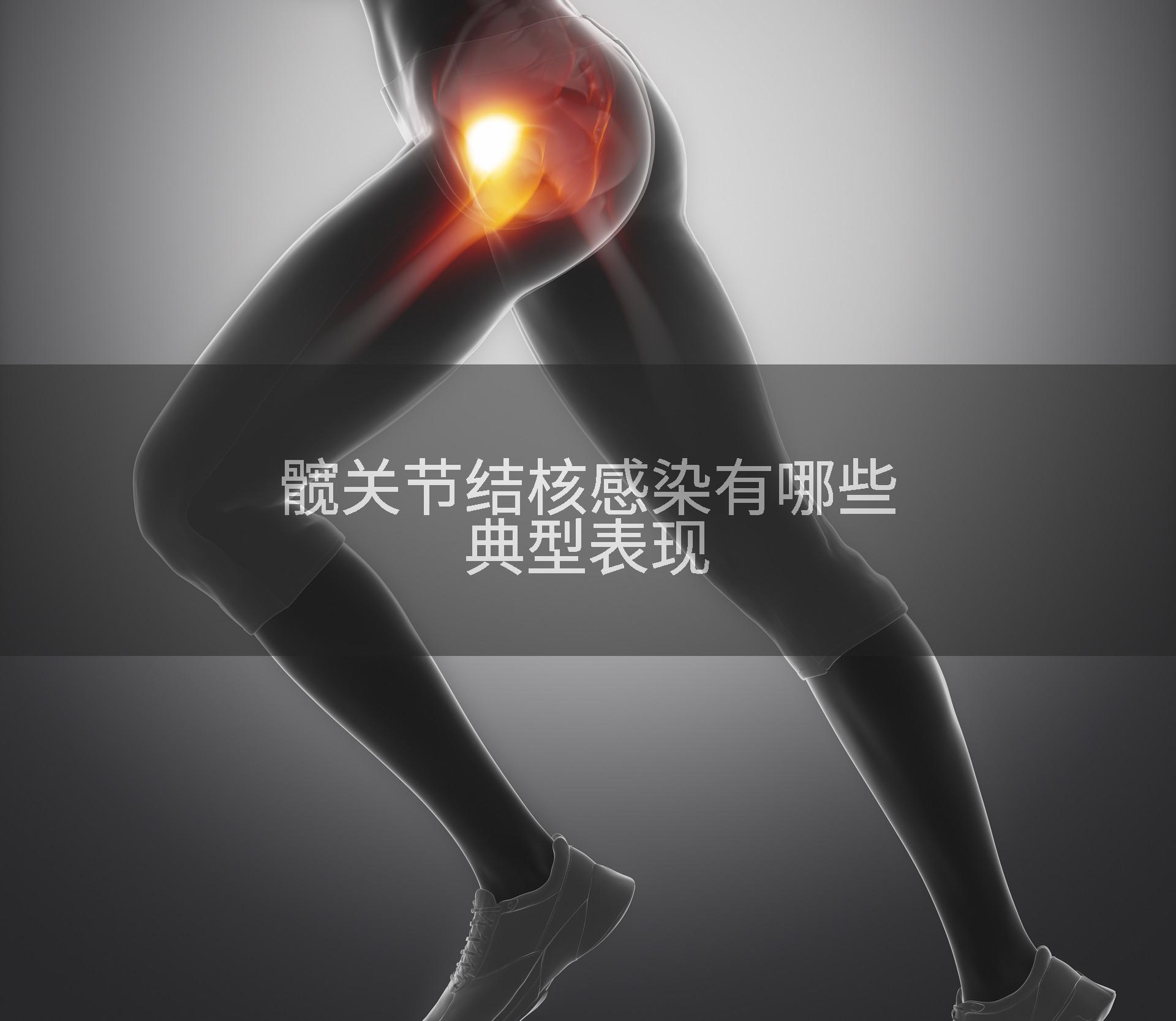 髋关节结核感染有哪些典型表现