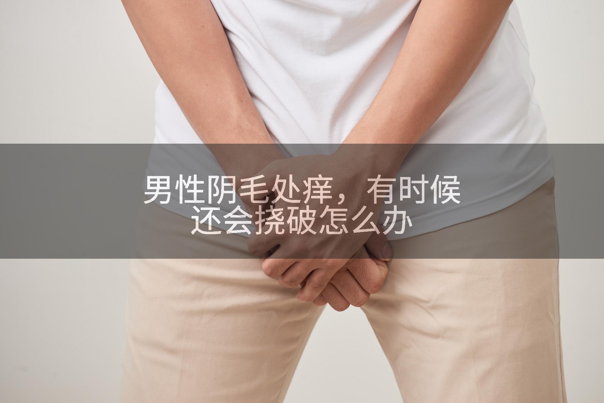 男性阴毛处痒,有时候还会挠破怎么办
