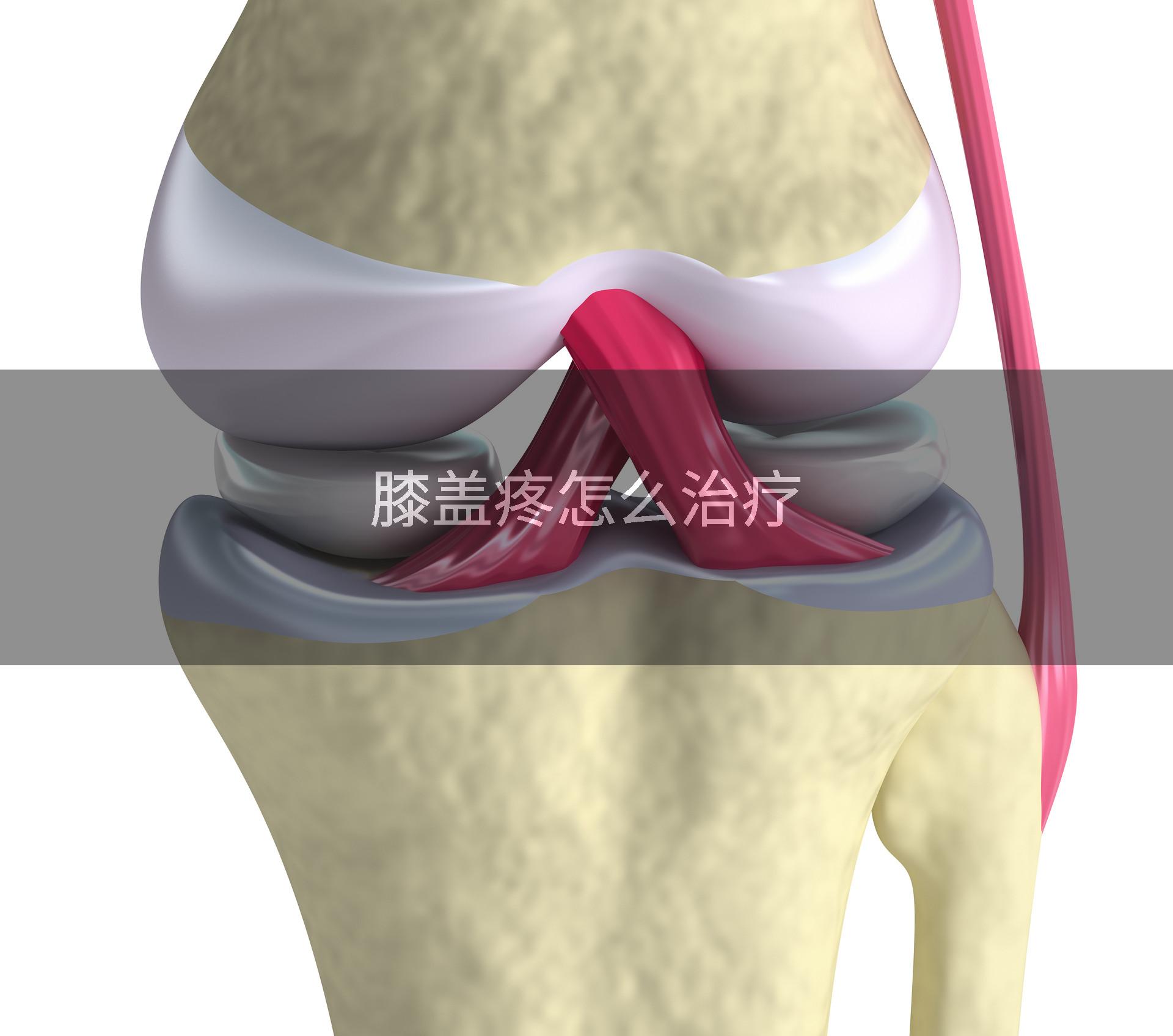 膝盖疼怎么治疗