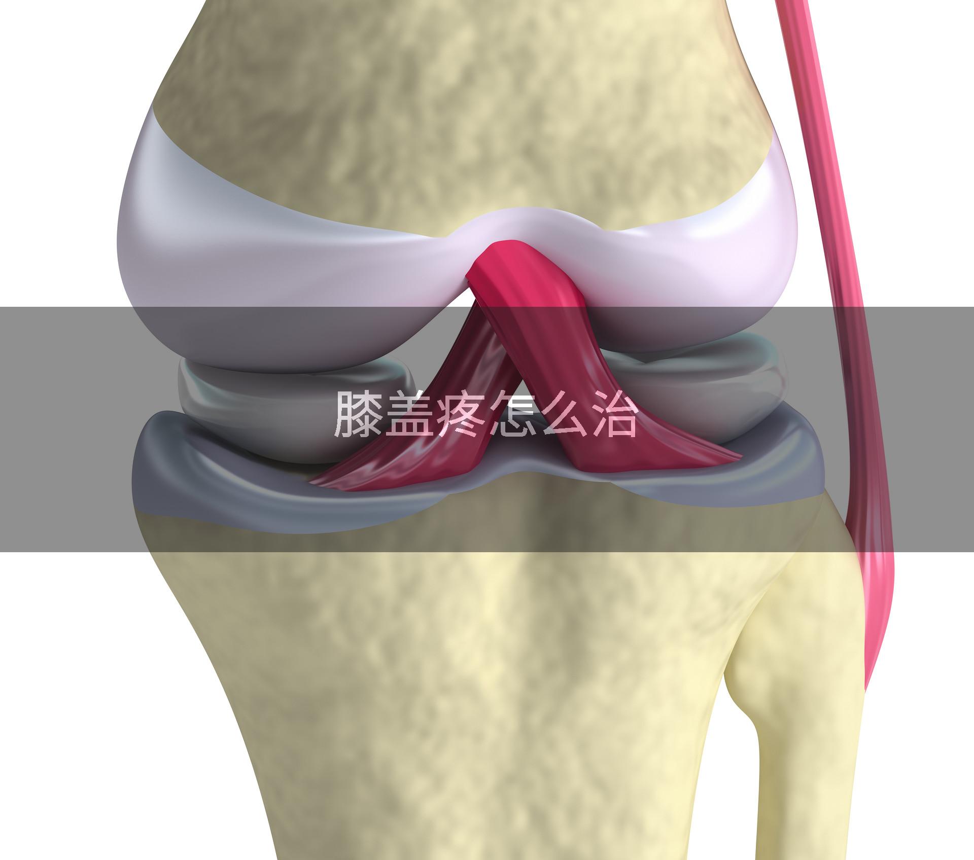 膝盖疼怎么治