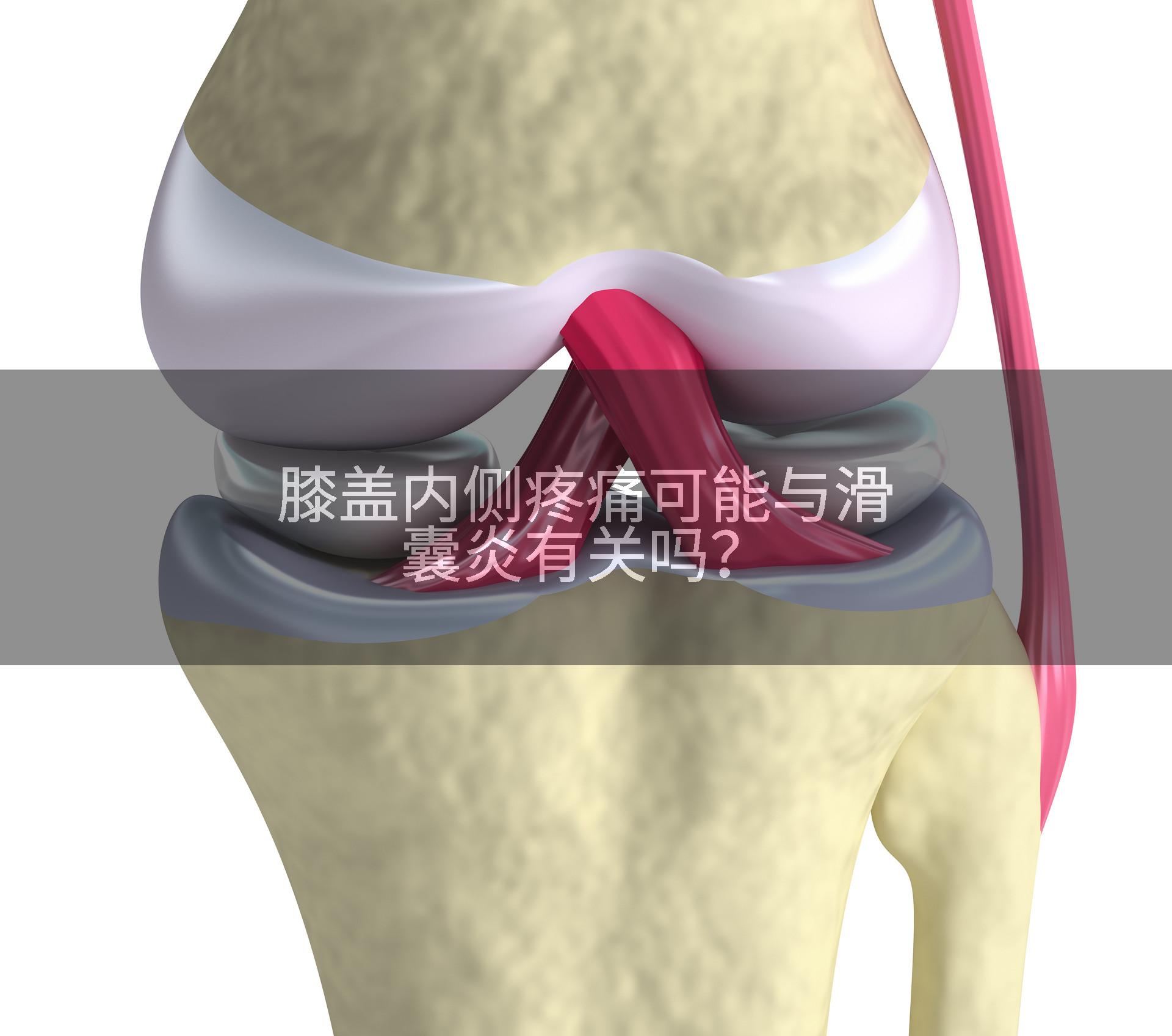 膝盖内侧疼痛可能与滑囊炎有关吗?