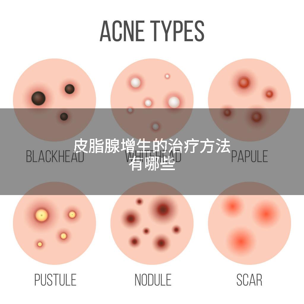 皮脂腺增生的治疗方法有哪些