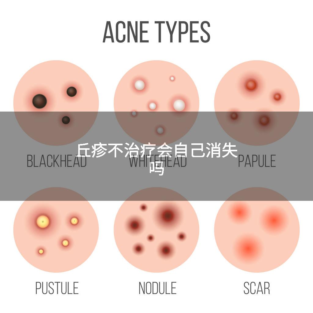 丘疹不治疗会自己消失吗