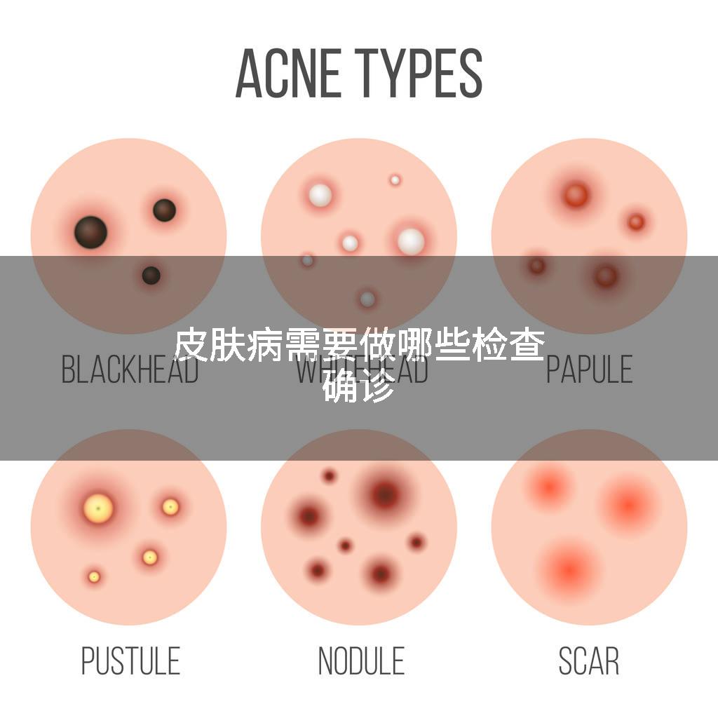 皮肤病需要做哪些检查确诊