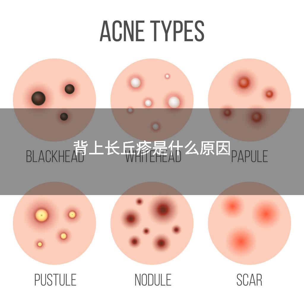 背上长丘疹是什么原因