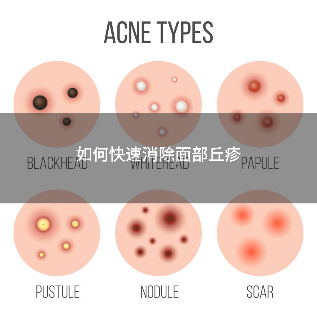 如何快速消除面部丘疹