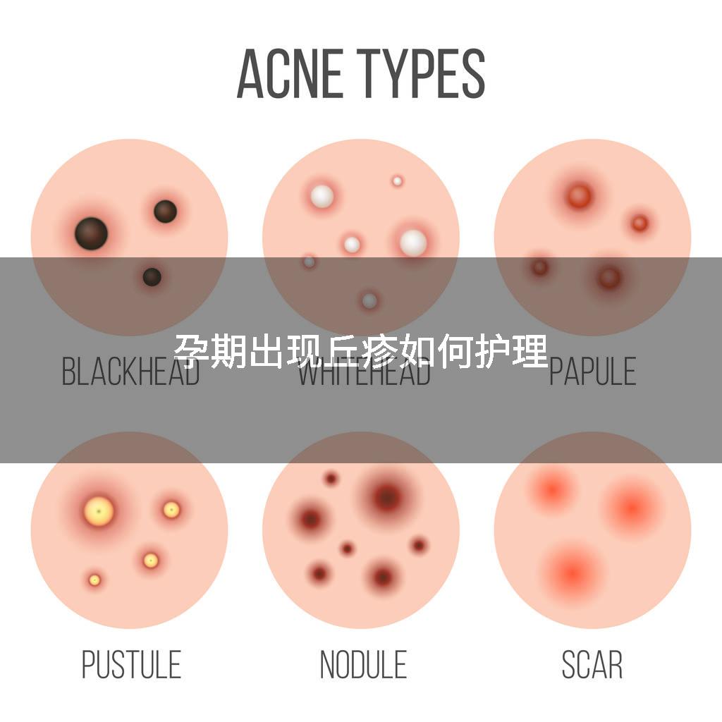 孕期出现丘疹如何护理