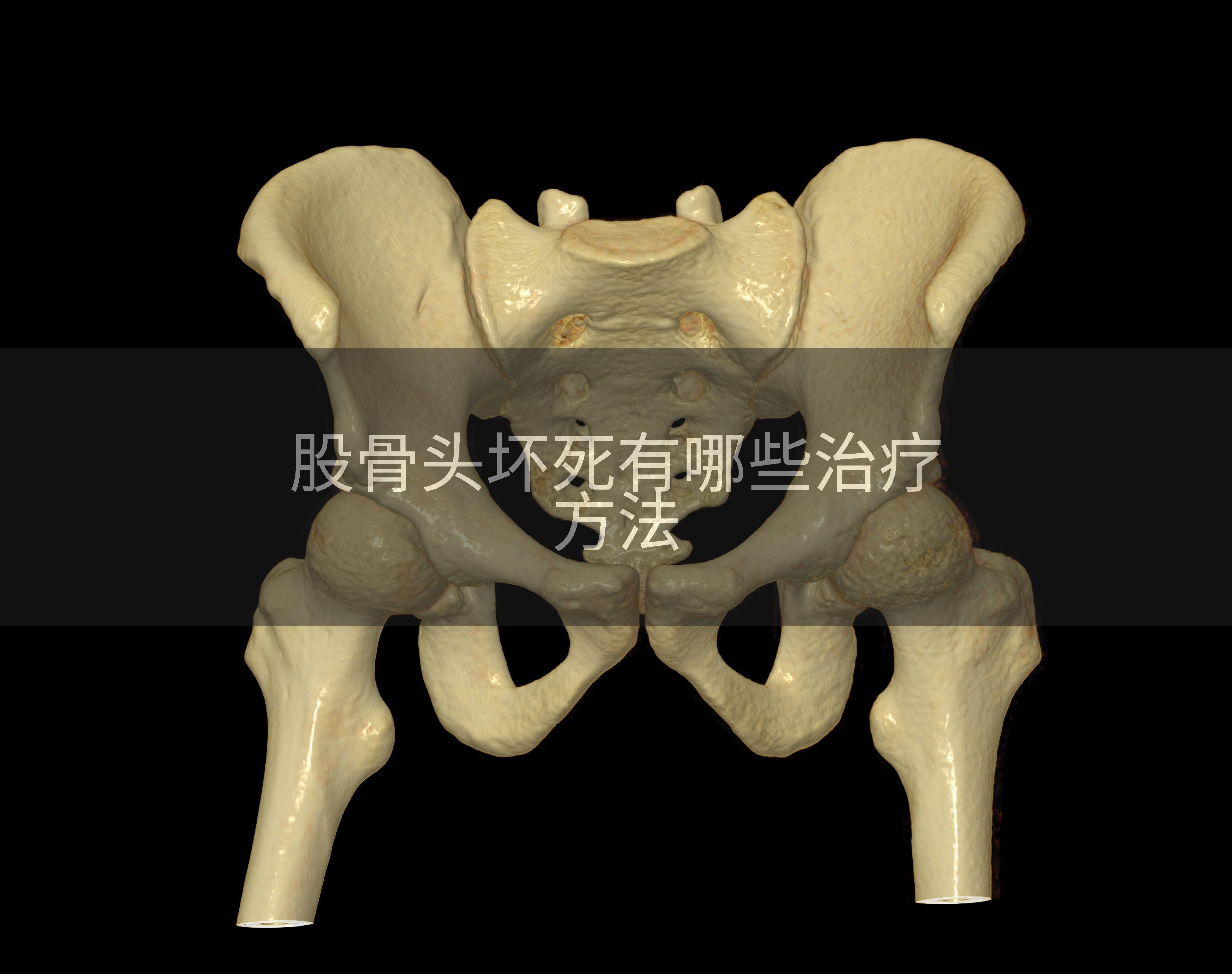 股骨头坏死有哪些治疗方法
