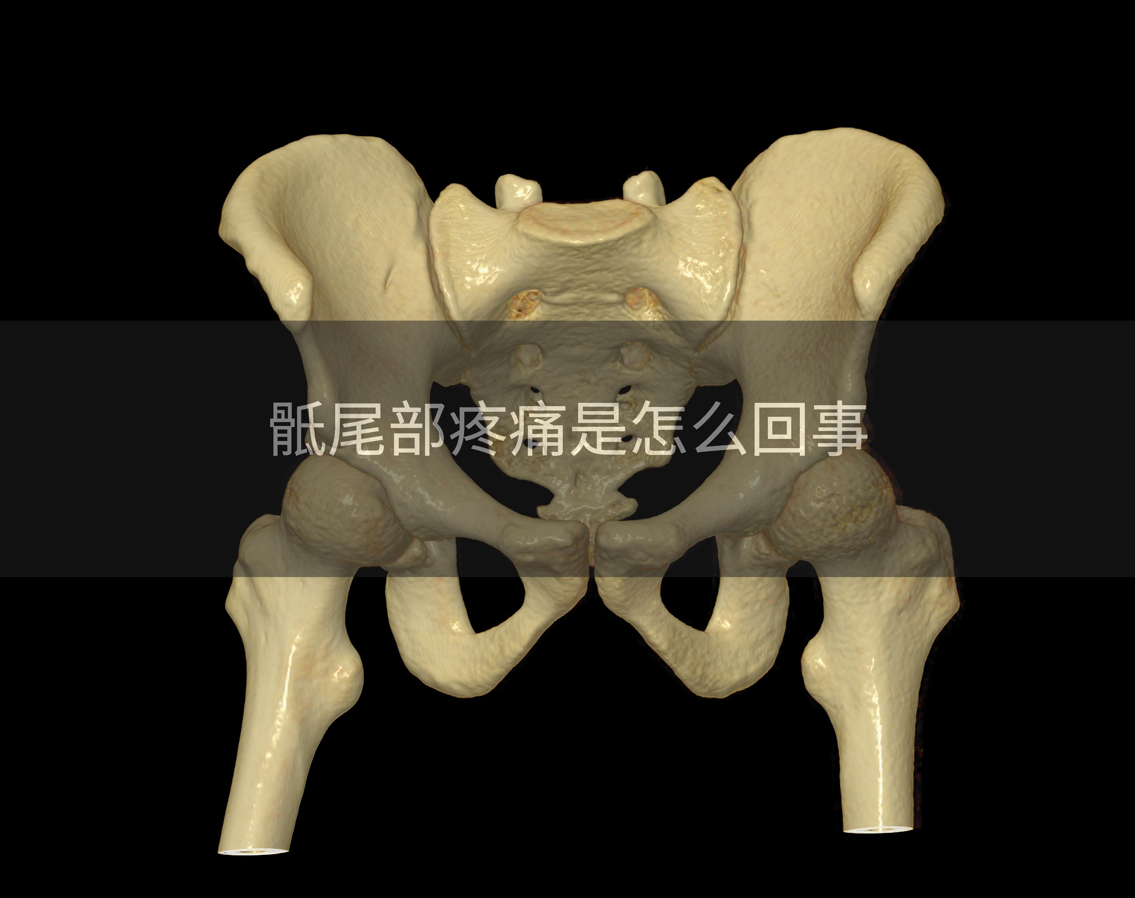 骶尾部疼痛是怎么回事