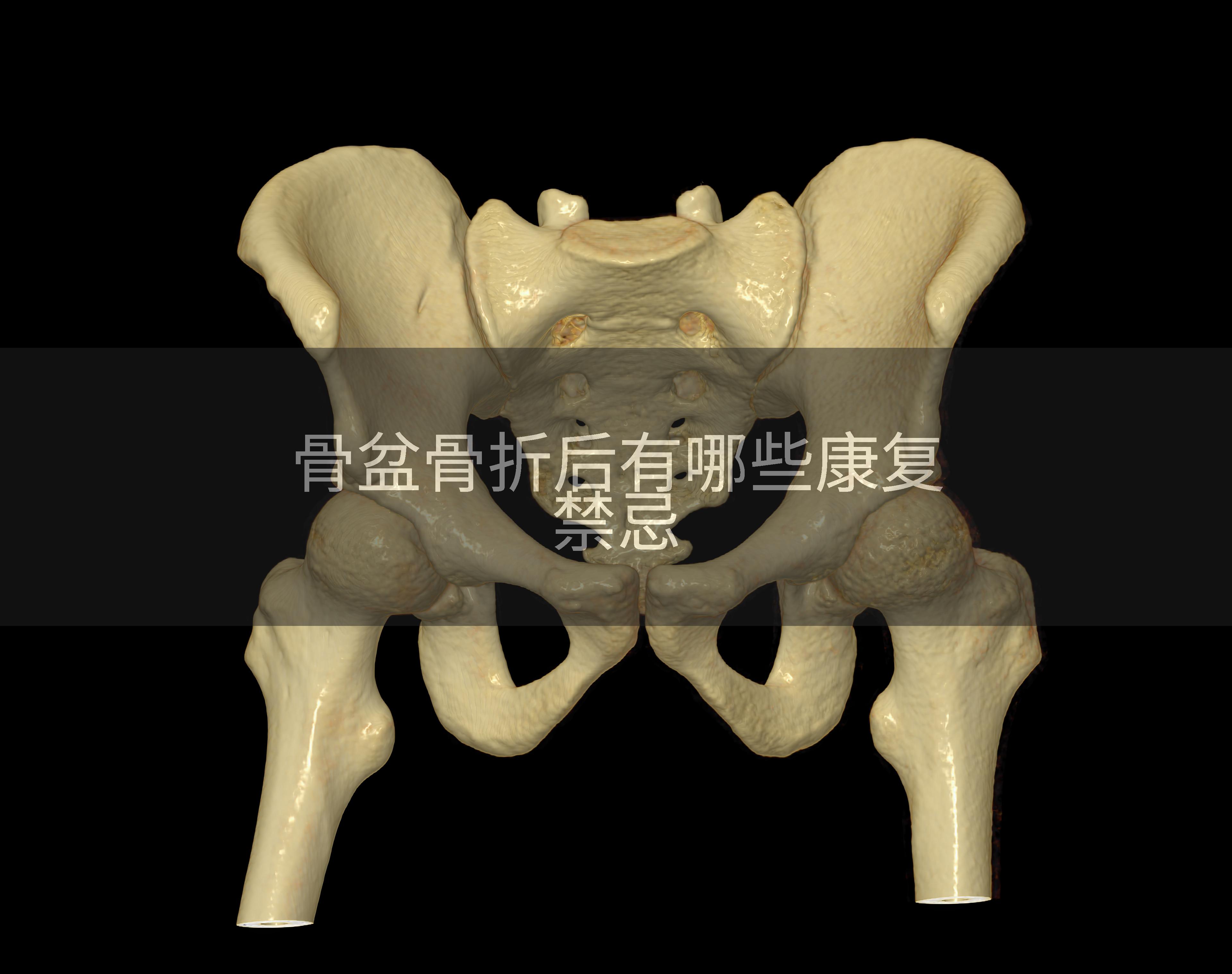 骨盆骨折后有哪些康复禁忌