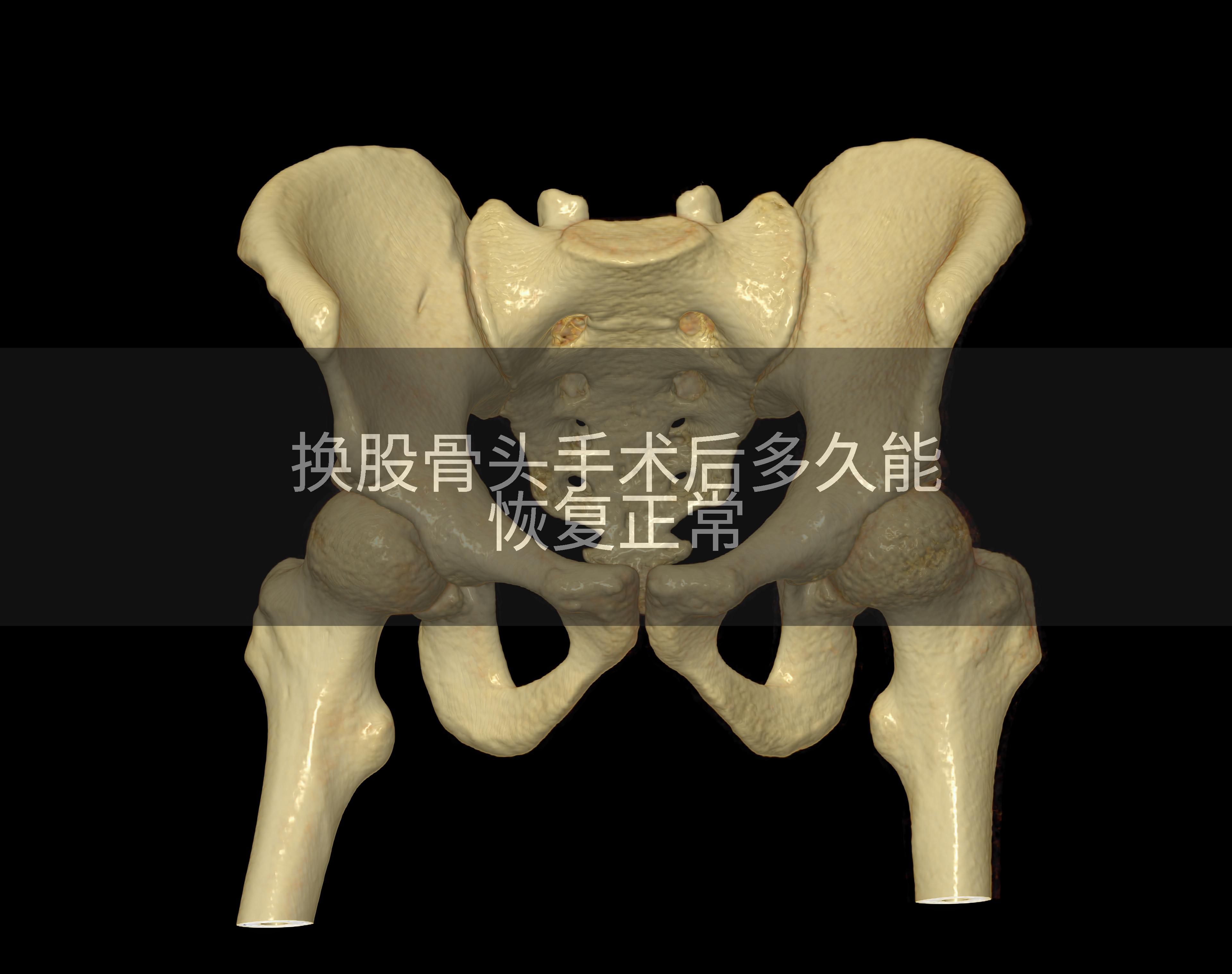 换股骨头手术后多久能恢复正常