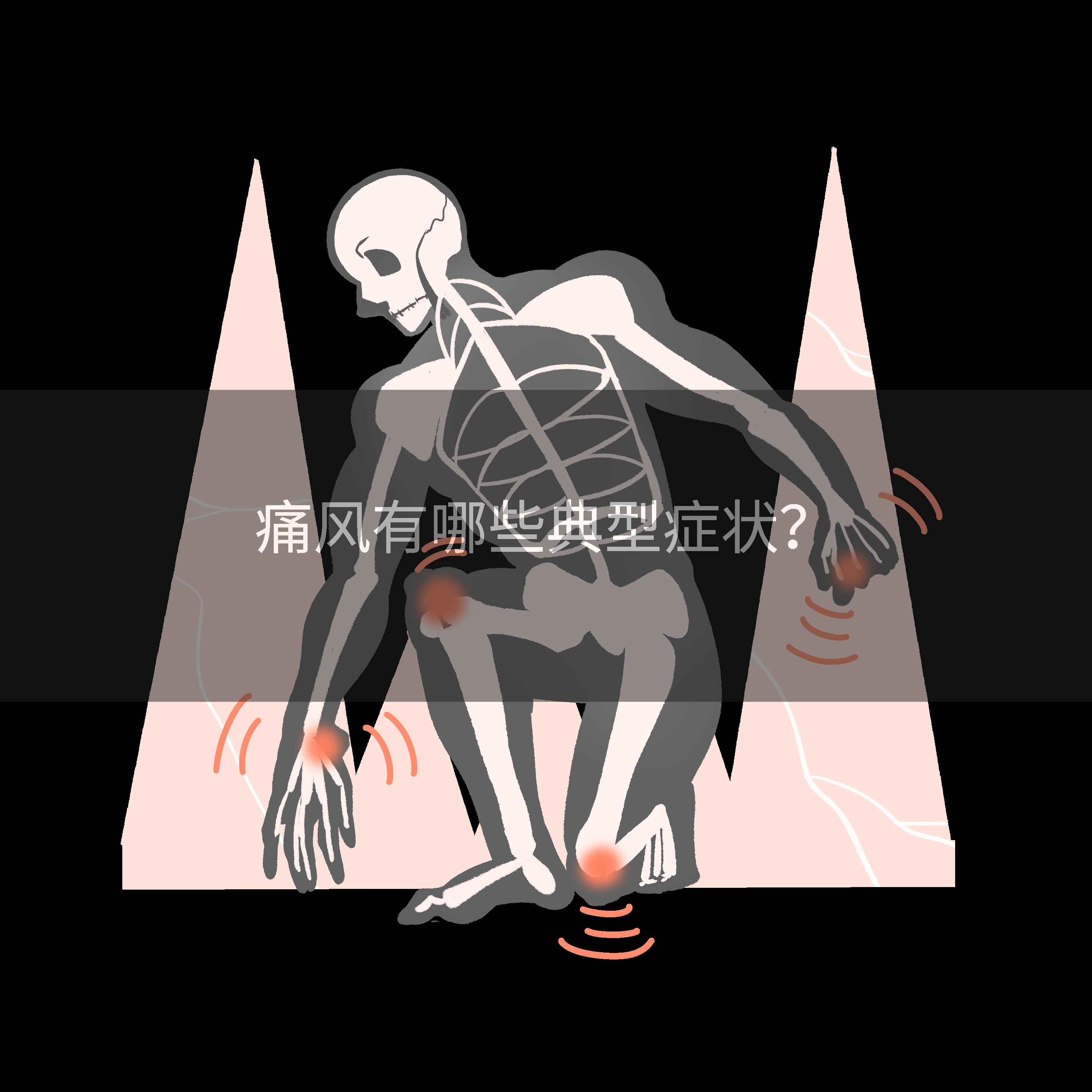 痛风有哪些典型症状?