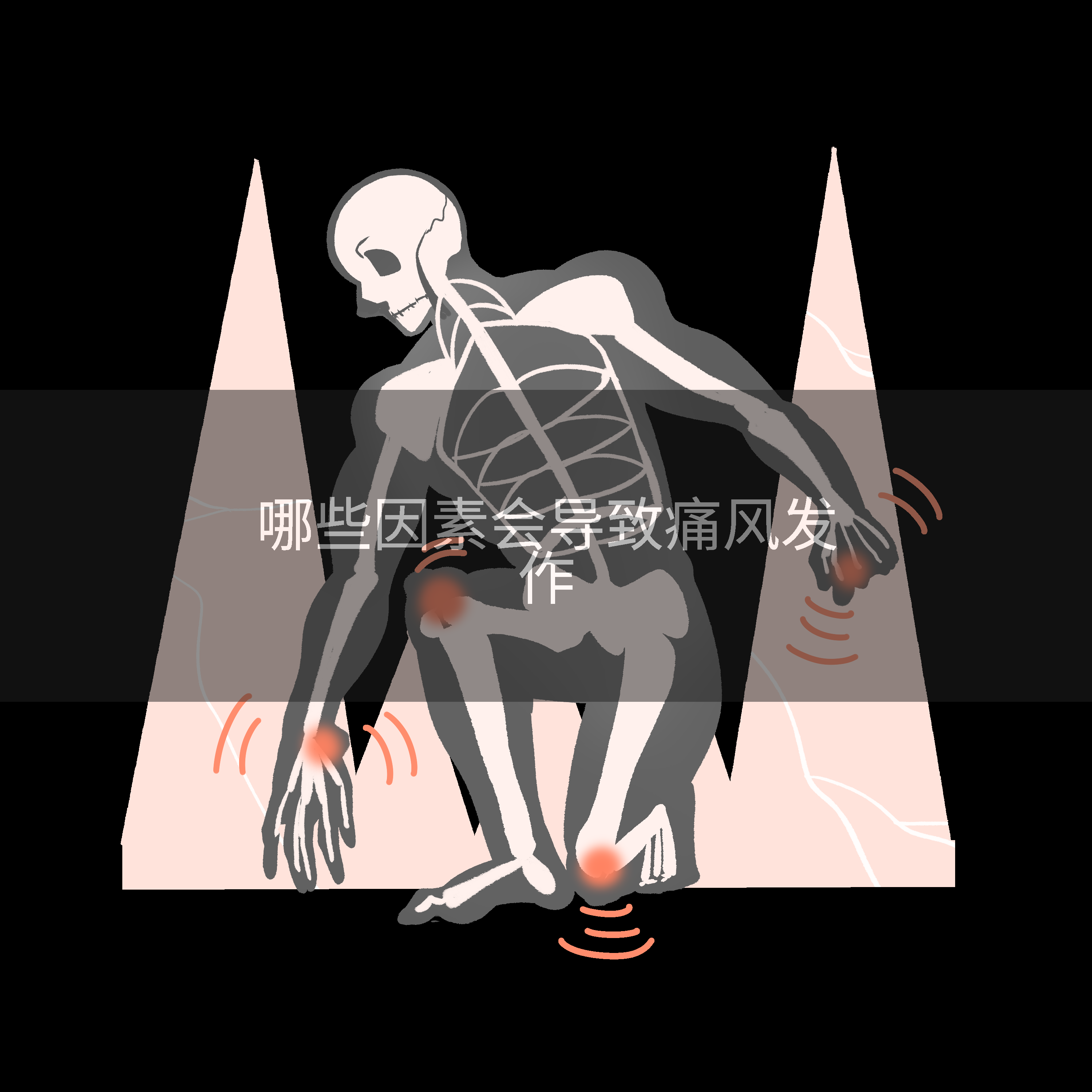 哪些因素会导致痛风发作