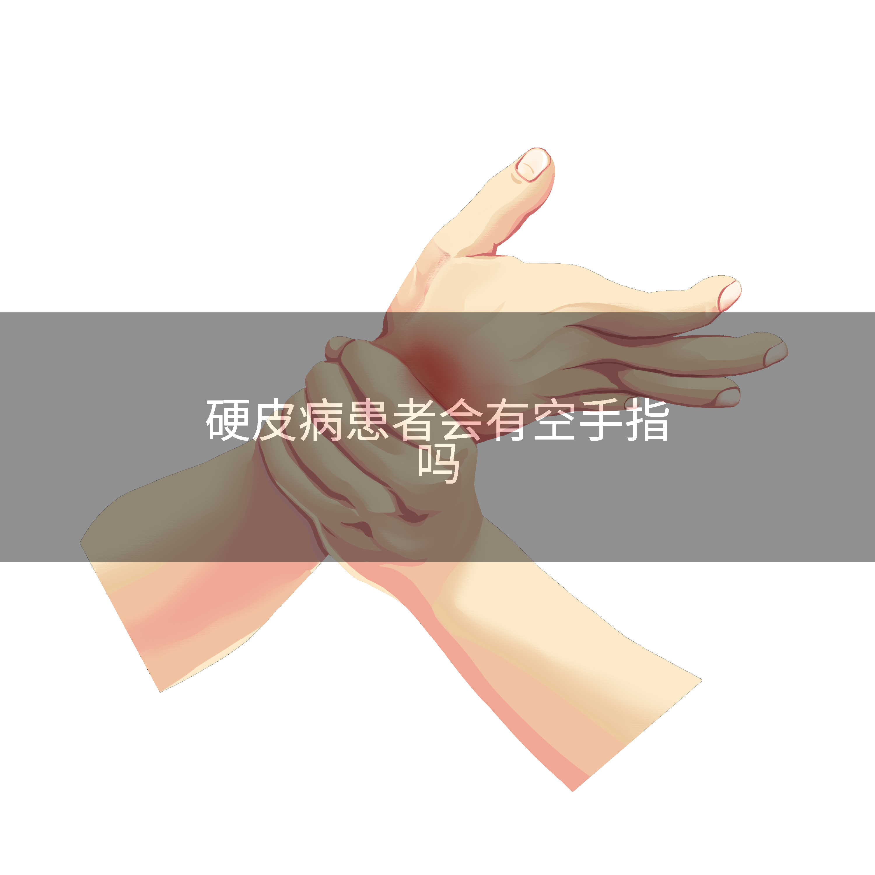 硬皮病患者会有空手指吗