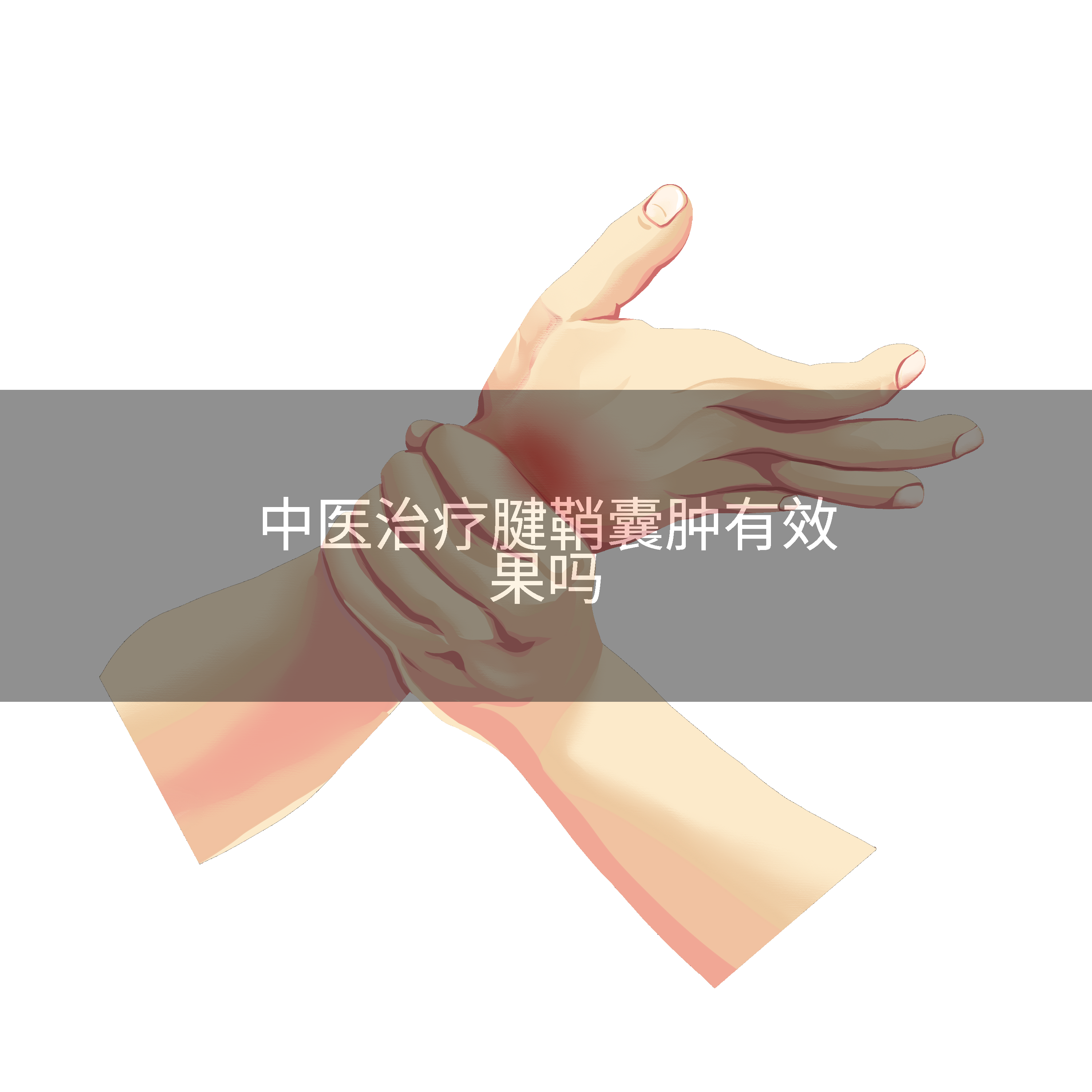 中医治疗腱鞘囊肿有效果吗