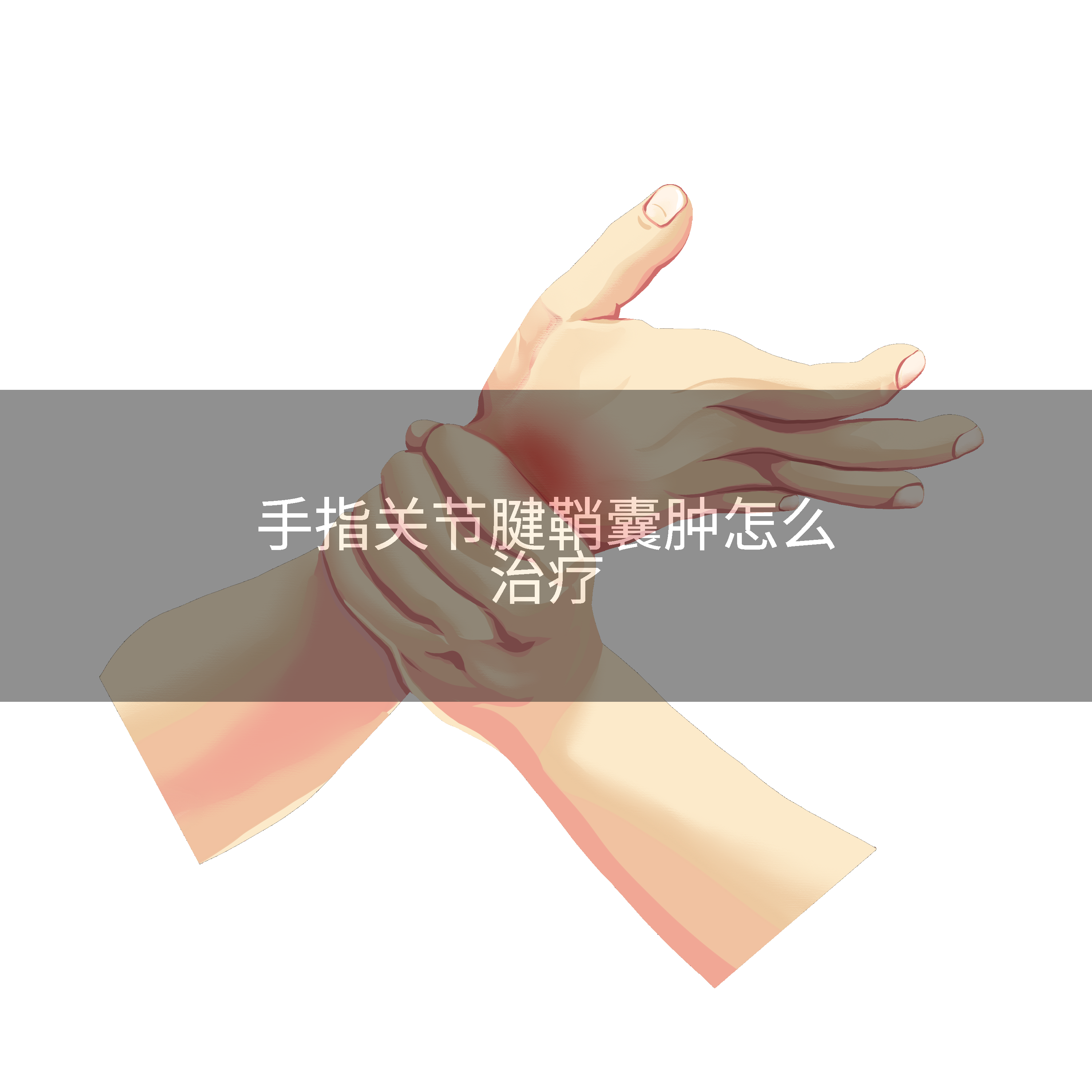 手指关节腱鞘囊肿怎么治疗
